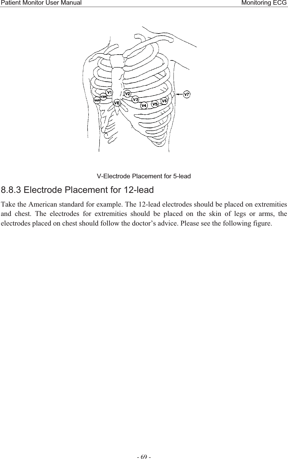 Patient Monitor User Manual                                                  Monitoring ECG  - 69 - V-Electrode Placement for 5-lead   8.8.3 Electrode Placement for 12-leadTake the American standard for example. The 12-lead electrodes should be placed on extremities and chest. The electrodes for extremities should be placed on the skin of legs or arms, the electrodes placed on chest should follow the doctor’s advice. Please see the following figure.