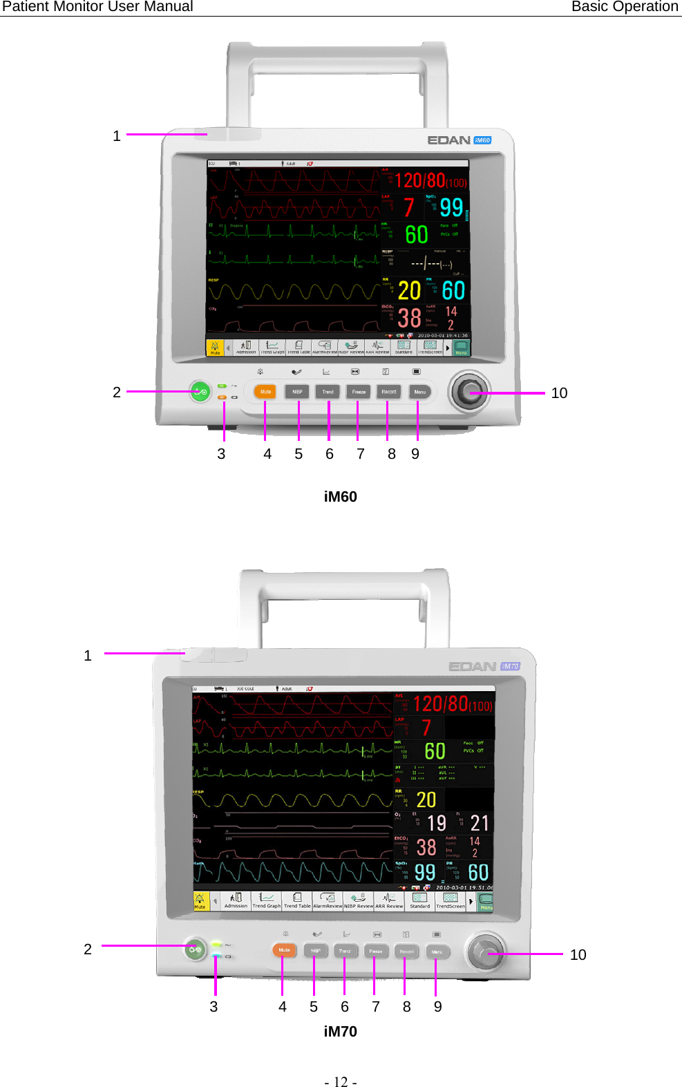 Patient Monitor User Manual                                                  Basic Operation  - 12 -  iM60   iM70 1                2 3     4   5   6   7   8  9 10 1                   2  10 3        4   5   6   7   8   9