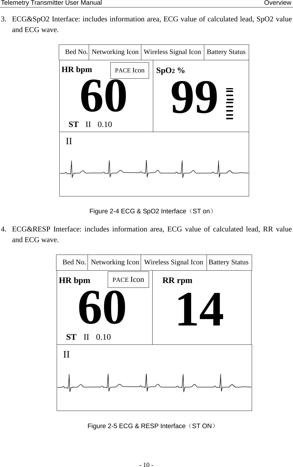 Telemetry Transmitter User Manual                                                  Overview 3. ECG&amp;SpO2 Interface: includes information area, ECG value of calculated lead, SpO2 value and ECG wave. 60 SpO2 %99HR bpmIIST II 0.10PACE IconBed No. Networking Icon Battery StatusWireless Signal Icon Figure 2-4 ECG &amp; SpO2 Interface（ST on） 4. ECG&amp;RESP Interface: includes information area, ECG value of calculated lead, RR value and ECG wave. 60 RR rpm14HR bpmIIST II 0.10PACE IconBed No. Networking Icon Battery StatusWireless Signal Icon Figure 2-5 ECG &amp; RESP Interface（ST ON）   - 10 - 