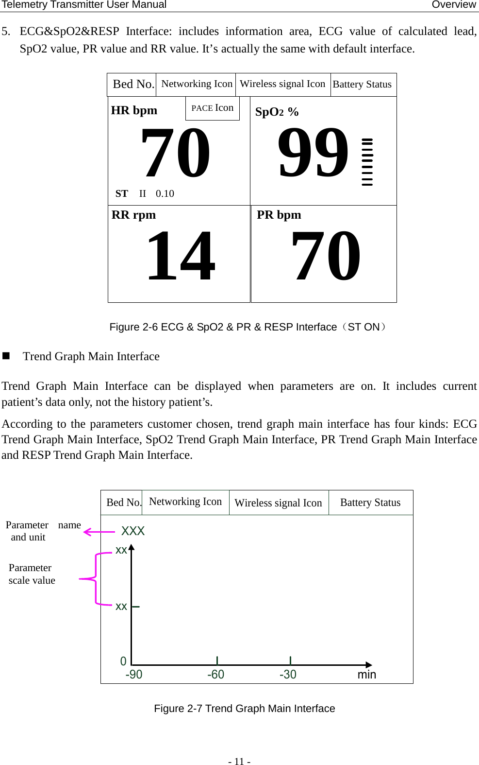 Telemetry Transmitter User Manual                                                  Overview 5. ECG&amp;SpO2&amp;RESP Interface: includes information area, ECG value of calculated lead, SpO2 value, PR value and RR value. It’s actually the same with default interface. 70SpO2 %99HR bpmRR rpm14ST II 0.10PR bpm70PACE IconBed No.Networking Icon Battery StatusWireless signal Icon Figure 2-6 ECG &amp; SpO2 &amp; PR &amp; RESP Interface（ST ON）  Trend Graph Main Interface Trend Graph Main Interface can be  displayed when parameters are  on.  It includes current patient’s data only, not the history patient’s.   According to the parameters customer chosen, trend graph main interface has four kinds: ECG Trend Graph Main Interface, SpO2 Trend Graph Main Interface, PR Trend Graph Main Interface and RESP Trend Graph Main Interface.          Networking IconBed No.Wireless signal Icon Battery StatusminXXX0xx-90                    -60                 -30xx   Figure 2-7 Trend Graph Main Interface  Parameter name and unit Parameter scale value  - 11 - 