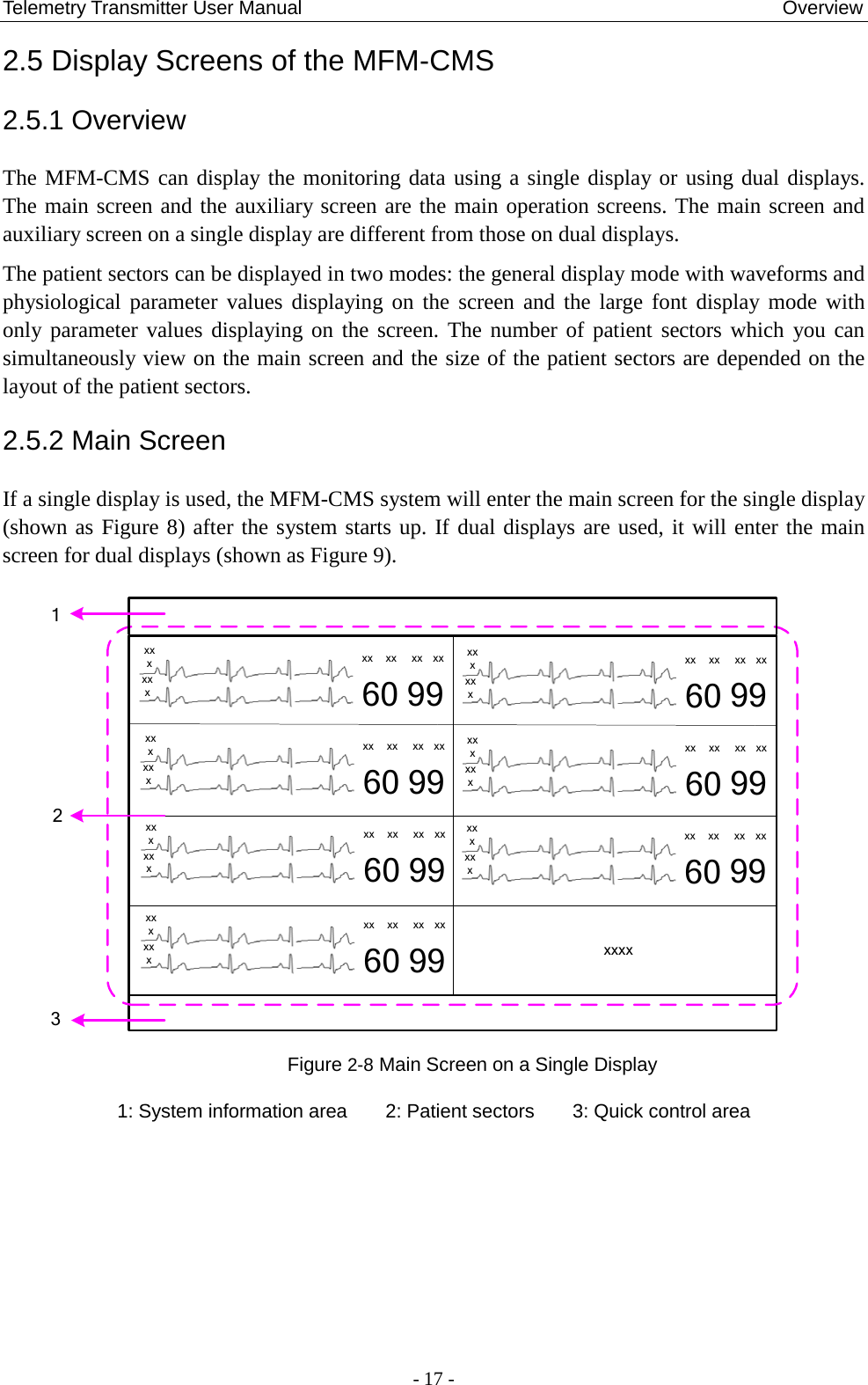 Telemetry Transmitter User Manual                                                  Overview 2.5 Display Screens of the MFM-CMS   2.5.1 Overview The MFM-CMS can display the monitoring data using a single display or using dual displays. The main screen and the auxiliary screen are the main operation screens. The main screen and auxiliary screen on a single display are different from those on dual displays. The patient sectors can be displayed in two modes: the general display mode with waveforms and physiological parameter values displaying on the screen and the large font display mode with only parameter values displaying on the screen. The number of patient sectors which you can simultaneously view on the main screen and the size of the patient sectors are depended on the layout of the patient sectors.   2.5.2 Main Screen If a single display is used, the MFM-CMS system will enter the main screen for the single display (shown as Figure 8) after the system starts up. If dual displays are used, it will enter the main screen for dual displays (shown as Figure 9). xxxxxxxx xx xx xx60 99xxxxxxxx xx xx xx60 99xxxxxxxx xx xx xx60 99xxxxxxxx xx xx xx60 99xxxxxxxx xx xx xx60 99xxxxxxxx xx xx xx60 99xxxxxxxx xx xx xx60 99132xxxx Figure 2-8 Main Screen on a Single Display  1: System information area        2: Patient sectors        3: Quick control area  - 17 - 