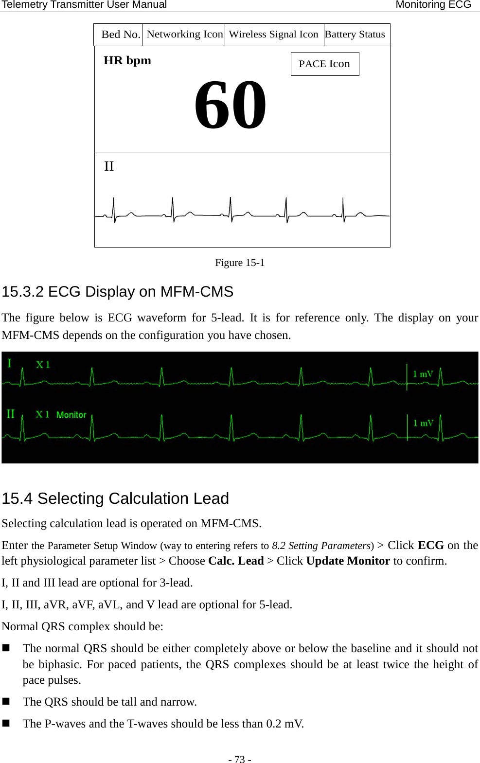 Telemetry Transmitter User Manual                                           Monitoring ECG 60HR bpmIIPACE IconBed No.Networking Icon Battery StatusWireless Signal Icon Figure 15-1 15.3.2 ECG Display on MFM-CMS The  figure below is  ECG waveform for 5-lead.  It  is for reference only. The display on your MFM-CMS depends on the configuration you have chosen.  15.4 Selecting Calculation Lead Selecting calculation lead is operated on MFM-CMS.   Enter the Parameter Setup Window (way to entering refers to 8.2 Setting Parameters) &gt; Click ECG on the left physiological parameter list &gt; Choose Calc. Lead &gt; Click Update Monitor to confirm. I, II and III lead are optional for 3-lead. I, II, III, aVR, aVF, aVL, and V lead are optional for 5-lead. Normal QRS complex should be:  The normal QRS should be either completely above or below the baseline and it should not be biphasic. For paced patients, the QRS complexes should be at least twice the height of pace pulses.    The QRS should be tall and narrow.  The P-waves and the T-waves should be less than 0.2 mV. - 73 - 