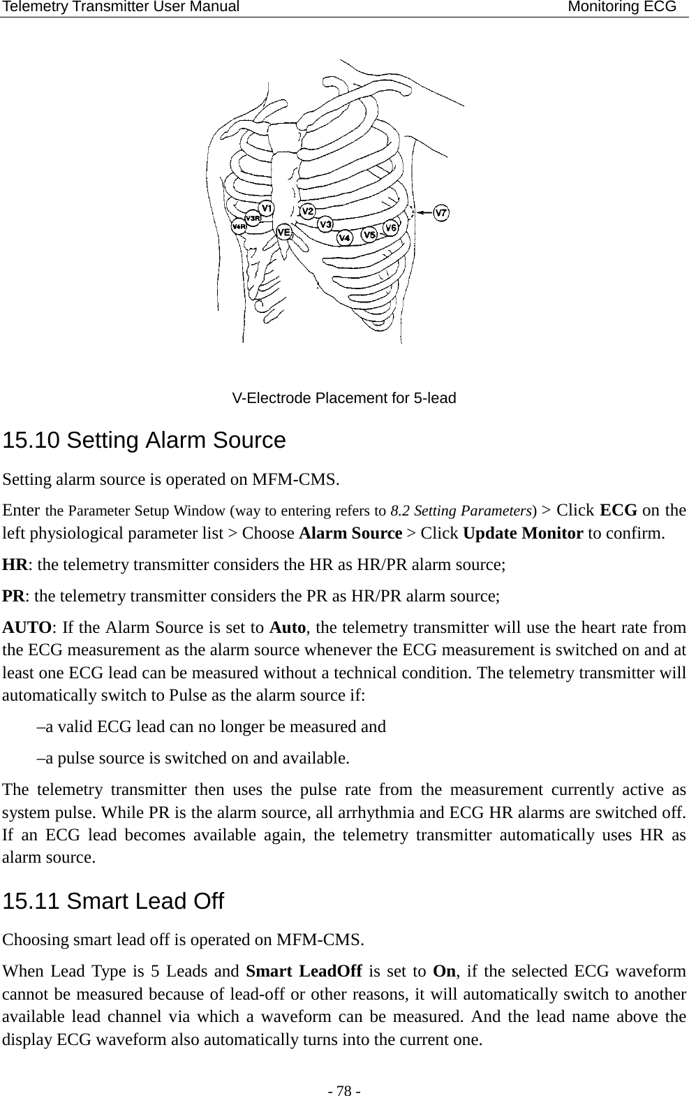 Telemetry Transmitter User Manual                                           Monitoring ECG  V-Electrode Placement for 5-lead   15.10 Setting Alarm Source Setting alarm source is operated on MFM-CMS.   Enter the Parameter Setup Window (way to entering refers to 8.2 Setting Parameters) &gt; Click ECG on the left physiological parameter list &gt; Choose Alarm Source &gt; Click Update Monitor to confirm. HR: the telemetry transmitter considers the HR as HR/PR alarm source; PR: the telemetry transmitter considers the PR as HR/PR alarm source; AUTO: If the Alarm Source is set to Auto, the telemetry transmitter will use the heart rate from the ECG measurement as the alarm source whenever the ECG measurement is switched on and at least one ECG lead can be measured without a technical condition. The telemetry transmitter will automatically switch to Pulse as the alarm source if: –a valid ECG lead can no longer be measured and   –a pulse source is switched on and available. The  telemetry transmitter then uses the pulse rate from the measurement currently active as system pulse. While PR is the alarm source, all arrhythmia and ECG HR alarms are switched off. If an ECG lead becomes available again, the telemetry transmitter automatically uses HR as alarm source. 15.11 Smart Lead Off Choosing smart lead off is operated on MFM-CMS.   When Lead Type is 5 Leads and Smart LeadOff is set to On, if the selected ECG waveform cannot be measured because of lead-off or other reasons, it will automatically switch to another available lead channel via which a waveform can be measured. And the lead name above the display ECG waveform also automatically turns into the current one. - 78 - 