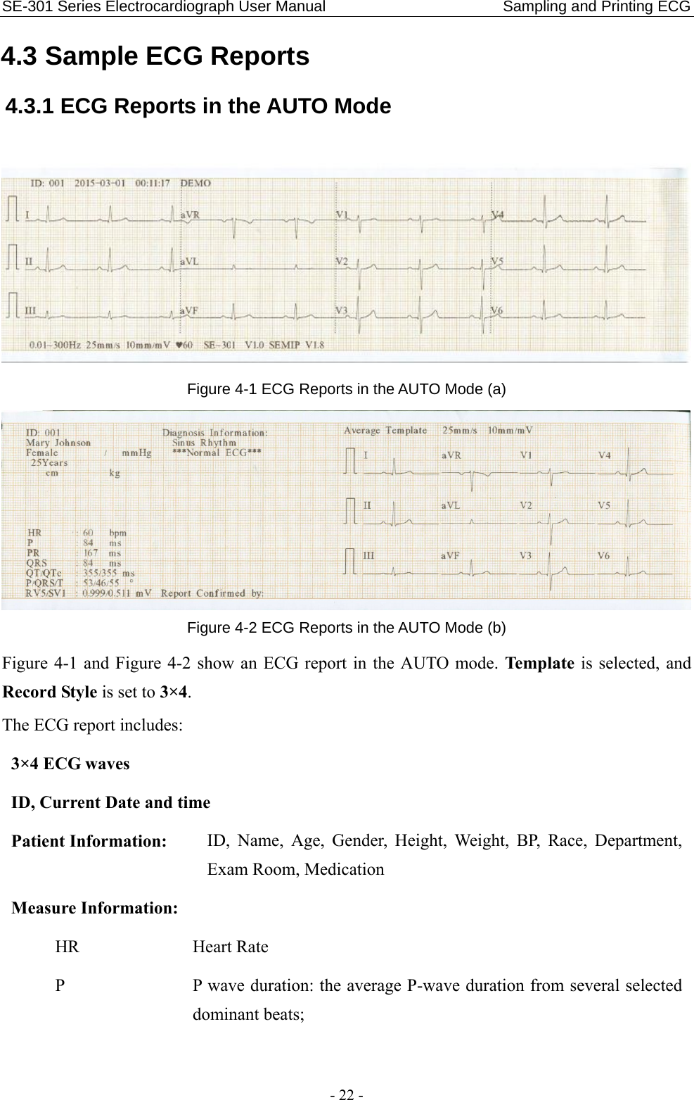 SE-301 Series Electrocardiograph User Manual                       Sampling and Printing ECG - 22 - 4.3 Sample ECG Reports 4.3.1 ECG Reports in the AUTO Mode  Figure 4-1 ECG Reports in the AUTO Mode (a)  Figure 4-2 ECG Reports in the AUTO Mode (b) Figure 4-1 and Figure 4-2 show an ECG report in the AUTO mode. Template is selected, and Record Style is set to 3×4. The ECG report includes:   3×4 ECG waves  ID, Current Date and time Patient Information: ID, Name, Age, Gender, Height, Weight, BP, Race, Department, Exam Room, Medication   Measure Information:   HR Heart Rate P  P wave duration: the average P-wave duration from several selected dominant beats; 
