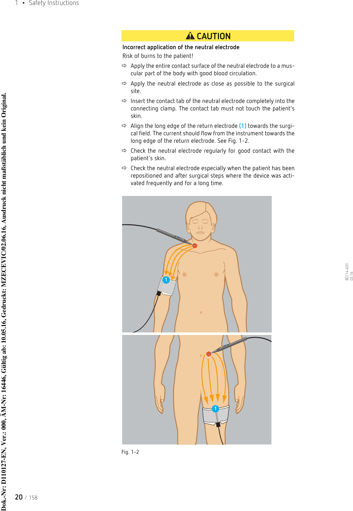 1  • Safety Instructions20 / 15880114-601  03.16CAUTIONIncorrect application of the neutral electrodeRisk of burns to the patient!Apply the entire contact surface of the neutral electrode to a mus-cular part of the body with good blood circulation.Apply the neutral electrode as close as possible to the surgical site.Insert the contact tab of the neutral electrode completely into the connecting clamp. The contact tab must not touch the patient&apos;s skin. Align the long edge of the return electrode (1) towards the surgi-cal field. The current should flow from the instrument towards the long edge of the return electrode. See Fig. 1-2.Check the neutral electrode regularly for good contact with the patient&apos;s skin.Check the neutral electrode especially when the patient has been repositioned and after surgical steps where the device was acti-vated frequently and for a long time. Fig. 1-211Dok.-Nr: D110127-EN, Ver.: 000, ÄM-Nr: 16446, Gültig ab: 10.05.16, Gedruckt: MZECEVIC/02.06.16, Ausdruck nicht maßstäblich und kein Original.Dok.-Nr: D110127-EN, Ver.: 000, ÄM-Nr: 16446, Gültig ab: 10.05.16, Gedruckt: MZECEVIC/02.06.16, Ausdruck nicht maßstäblich und kein Original.