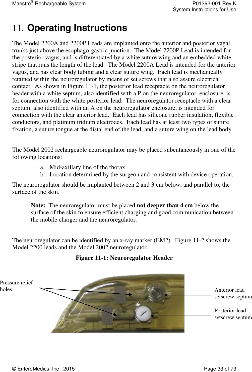Maestro® Rechargeable System    P01392-001 Rev K     System Instructions for Use  © EnteroMedics, Inc   2015  Page 33 of 73  11. Operating Instructions The Model 2200A and 2200P Leads are implanted onto the anterior and posterior vagal trunks just above the esophago-gastric junction.  The Model 2200P Lead is intended for the posterior vagus, and is differentiated by a white suture wing and an embedded white stripe that runs the length of the lead.  The Model 2200A Lead is intended for the anterior vagus, and has clear body tubing and a clear suture wing.  Each lead is mechanically retained within the neuroregulator by means of set screws that also assure electrical contact.  As shown in Figure 11-1, the posterior lead receptacle on the neuroregulator header with a white septum, also identified with a P on the neuroregulator  enclosure, is for connection with the white posterior lead.  The neuroregulator receptacle with a clear septum, also identified with an A on the neuroregulator enclosure, is intended for connection with the clear anterior lead.  Each lead has silicone rubber insulation, flexible conductors, and platinum iridium electrodes.  Each lead has at least two types of suture fixation, a suture tongue at the distal end of the lead, and a suture wing on the lead body.  The Model 2002 rechargeable neuroregulator may be placed subcutaneously in one of the following locations:  a. Mid-axillary line of the thorax  b. Location determined by the surgeon and consistent with device operation.   The neuroregulator should be implanted between 2 and 3 cm below, and parallel to, the surface of the skin. Note:  The neuroregulator must be placed not deeper than 4 cm below the surface of the skin to ensure efficient charging and good communication between the mobile charger and the neuroregulator.  The neuroregulator can be identified by an x-ray marker (EM2).  Figure 11-2 shows the Model 2200 leads and the Model 2002 neuroregulator.  Figure 11-1: Neuroregulator Header    Anterior lead setscrew septum Posterior lead setscrew septum Pressure relief holes 