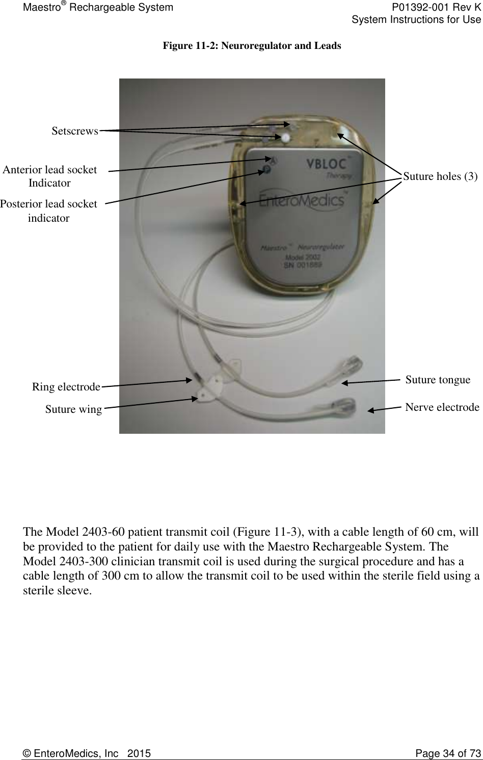 Maestro® Rechargeable System    P01392-001 Rev K     System Instructions for Use  © EnteroMedics, Inc   2015  Page 34 of 73  Figure 11-2: Neuroregulator and Leads       The Model 2403-60 patient transmit coil (Figure 11-3), with a cable length of 60 cm, will be provided to the patient for daily use with the Maestro Rechargeable System. The Model 2403-300 clinician transmit coil is used during the surgical procedure and has a cable length of 300 cm to allow the transmit coil to be used within the sterile field using a sterile sleeve.      Nerve electrode Suture tongue Suture holes (3) Suture wing Setscrews Anterior lead socket Indicator Posterior lead socket indicator Ring electrode 