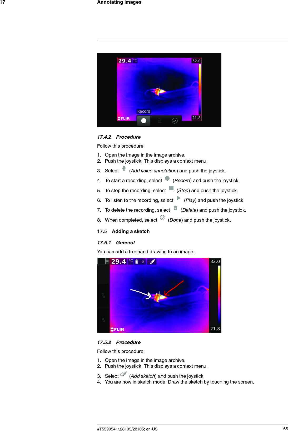 Annotating images1717.4.2 ProcedureFollow this procedure:1. Open the image in the image archive.2. Push the joystick. This displays a context menu.3. Select (Add voice annotation) and push the joystick.4. To start a recording, select (Record) and push the joystick.5. To stop the recording, select (Stop) and push the joystick.6. To listen to the recording, select (Play) and push the joystick.7. To delete the recording, select (Delete) and push the joystick.8. When completed, select (Done) and push the joystick.17.5 Adding a sketch17.5.1 GeneralYou can add a freehand drawing to an image.17.5.2 ProcedureFollow this procedure:1. Open the image in the image archive.2. Push the joystick. This displays a context menu.3. Select (Add sketch) and push the joystick.4. You are now in sketch mode. Draw the sketch by touching the screen.#T559954; r.28105/28105; en-US 65