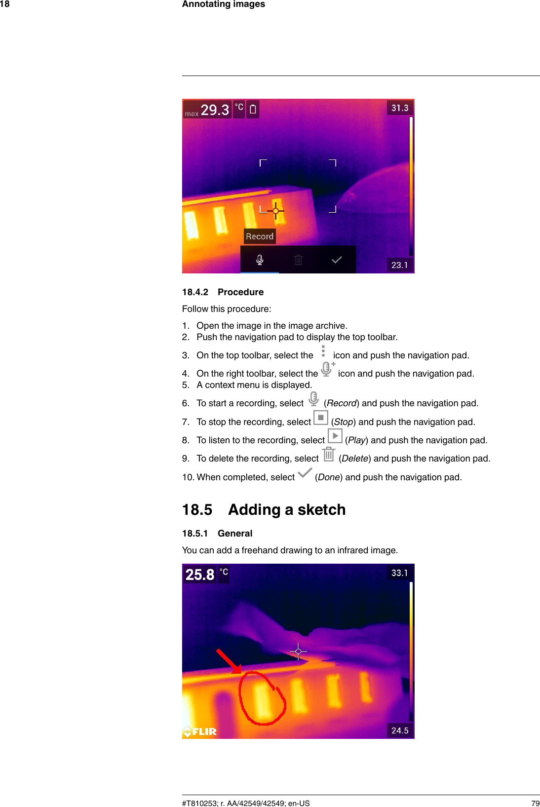 Annotating images1818.4.2 ProcedureFollow this procedure:1. Open the image in the image archive.2. Push the navigation pad to display the top toolbar.3. On the top toolbar, select the icon and push the navigation pad.4. On the right toolbar, select the icon and push the navigation pad.5. A context menu is displayed.6. To start a recording, select (Record) and push the navigation pad.7. To stop the recording, select (Stop) and push the navigation pad.8. To listen to the recording, select (Play) and push the navigation pad.9. To delete the recording, select (Delete) and push the navigation pad.10. When completed, select (Done) and push the navigation pad.18.5 Adding a sketch18.5.1 GeneralYou can add a freehand drawing to an infrared image.#T810253; r. AA/42549/42549; en-US 79