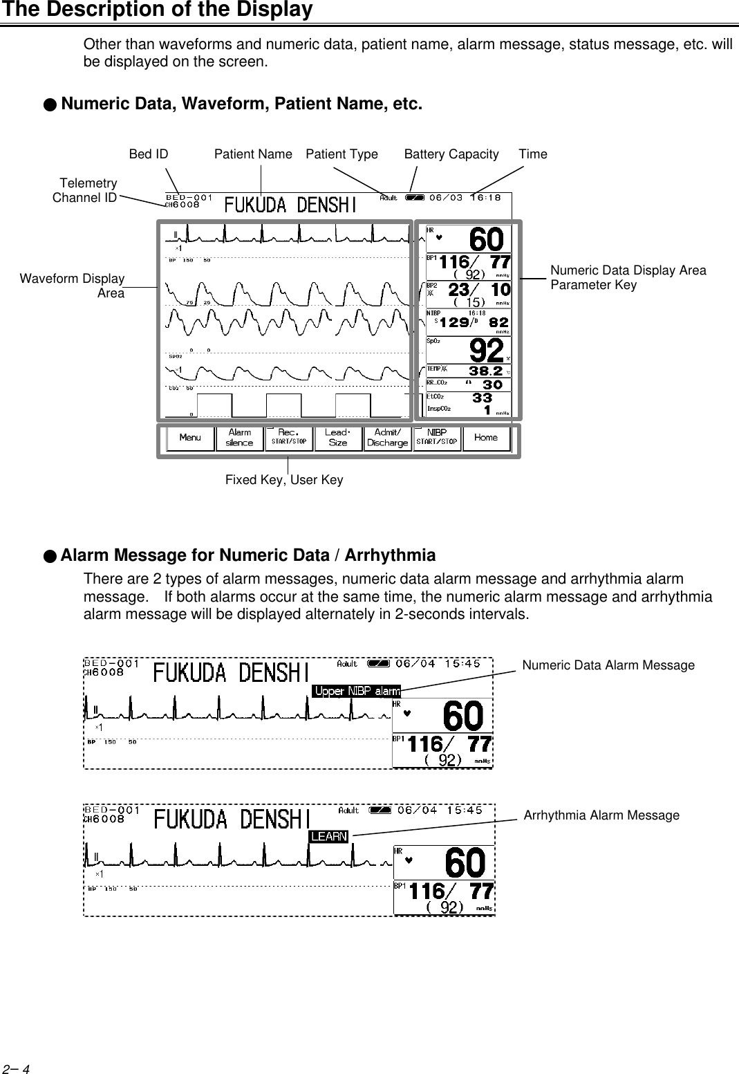 2−4The Description of the DisplayOther than waveforms and numeric data, patient name, alarm message, status message, etc. willbe displayed on the screen.● Numeric Data, Waveform, Patient Name, etc.●Alarm Message for Numeric Data / ArrhythmiaThere are 2 types of alarm messages, numeric data alarm message and arrhythmia alarmmessage.  If both alarms occur at the same time, the numeric alarm message and arrhythmiaalarm message will be displayed alternately in 2-seconds intervals.Bed ID       Patient Name  Patient Type    Battery Capacity   TimeNumeric Data Display AreaParameter KeyWaveform DisplayAreaFixed Key, User KeyNumeric Data Alarm MessageArrhythmia Alarm MessageTelemetryChannel ID