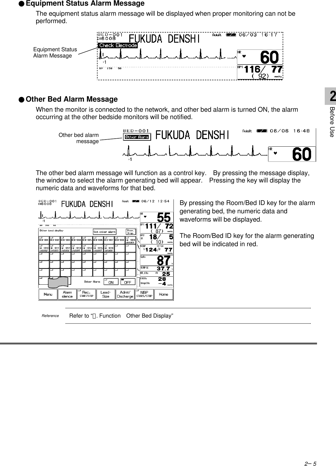 2−5●Equipment Status Alarm MessageThe equipment status alarm message will be displayed when proper monitoring can not beperformed.●Other Bed Alarm MessageWhen the monitor is connected to the network, and other bed alarm is turned ON, the alarmoccurring at the other bedside monitors will be notified.The other bed alarm message will function as a control key.  By pressing the message display,the window to select the alarm generating bed will appear.  Pressing the key will display thenumeric data and waveforms for that bed.By pressing the Room/Bed ID key for the alarmgenerating bed, the numeric data andwaveforms will be displayed.The Room/Bed ID key for the alarm generatingbed will be indicated in red.ReferenceRefer to “７. Function  Other Bed Display”Equipment StatusAlarm MessageOther bed alarmmessage2Before Use