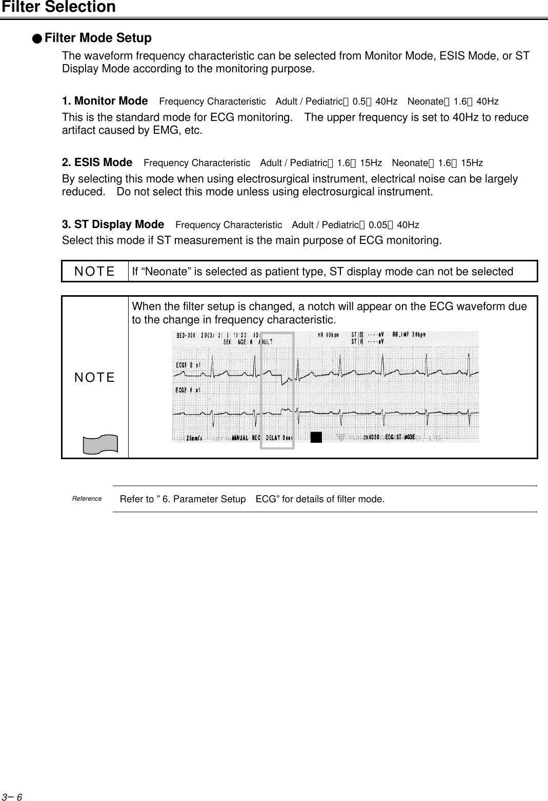 3−6Filter Selection●Filter Mode SetupThe waveform frequency characteristic can be selected from Monitor Mode, ESIS Mode, or STDisplay Mode according to the monitoring purpose.1. Monitor Mode  Frequency Characteristic  Adult / Pediatric：0.5∼40Hz  Neonate：1.6∼40HzThis is the standard mode for ECG monitoring.  The upper frequency is set to 40Hz to reduceartifact caused by EMG, etc.2. ESIS Mode  Frequency Characteristic  Adult / Pediatric：1.6∼15Hz  Neonate：1.6∼15HzBy selecting this mode when using electrosurgical instrument, electrical noise can be largelyreduced.  Do not select this mode unless using electrosurgical instrument.3. ST Display Mode  Frequency Characteristic  Adult / Pediatric：0.05∼40HzSelect this mode if ST measurement is the main purpose of ECG monitoring.NOTE If “Neonate” is selected as patient type, ST display mode can not be selectedNOTEWhen the filter setup is changed, a notch will appear on the ECG waveform dueto the change in frequency characteristic.ReferenceRefer to ” 6. Parameter Setup  ECG” for details of filter mode.