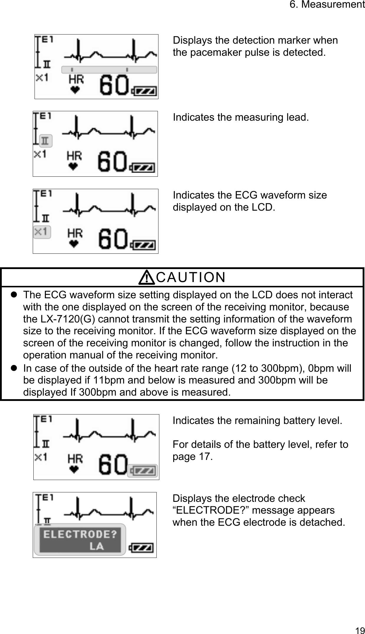 6. Measurement   19    Displays the detection marker when the pacemaker pulse is detected.   Indicates the measuring lead.  Indicates the ECG waveform size displayed on the LCD.  CAUTION   The ECG waveform size setting displayed on the LCD does not interact with the one displayed on the screen of the receiving monitor, because the LX-7120(G) cannot transmit the setting information of the waveform size to the receiving monitor. If the ECG waveform size displayed on the screen of the receiving monitor is changed, follow the instruction in the operation manual of the receiving monitor.   In case of the outside of the heart rate range (12 to 300bpm), 0bpm will be displayed if 11bpm and below is measured and 300bpm will be displayed If 300bpm and above is measured.  Indicates the remaining battery level.  For details of the battery level, refer to page 17.   Displays the electrode check “ELECTRODE?” message appears when the ECG electrode is detached.