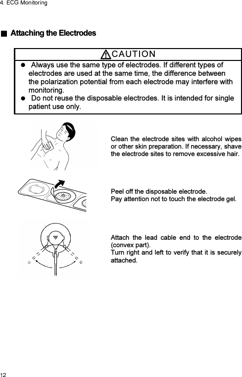    Attaching the Electrodes  CAUTI O N    Always use the same type of electrodes. If different types of electrodes are used at the same time, the difference between the polarization potential from each electrode may interfere with monitoring.   Do not reuse the disposable electrodes. It is intended for single patient use only.  Clean the electrode sites with  alcohol  wipes or other skin preparation. If necessary, shave the electrode sites to remove excessive hair.  Peel off the disposable electrode. Pay attention not to touch the electrode gel.   Attach  the  lead  cable  end  to  the  electrode (convex part). Turn right and left to verify that it is securely attached.  