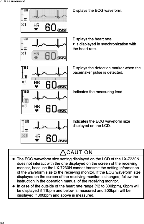  Displays the ECG waveform.     Displays the heart rate.    is displayed in synchronization with the heart rate.    Displays the detection marker when the pacemaker pulse is detected. Indicates the measuring lead.  Indicates the ECG waveform size displayed on the LCD. CAUTI O N    The ECG waveform size setting displayed on the LCD of the LX-7230N does not interact with the one displayed on the screen of the receiving monitor, because the LX-7230N cannot transmit the setting information of the waveform size to the receiving monitor. If the ECG waveform size displayed on the screen of the receiving monitor is changed, follow the instruction in the operation manual of the receiving monitor.   In case of the outside of the heart rate range (12 to 300bpm), 0bpm will be displayed if 11bpm and below is measured and 300bpm will be displayed If 300bpm and above is measured. 