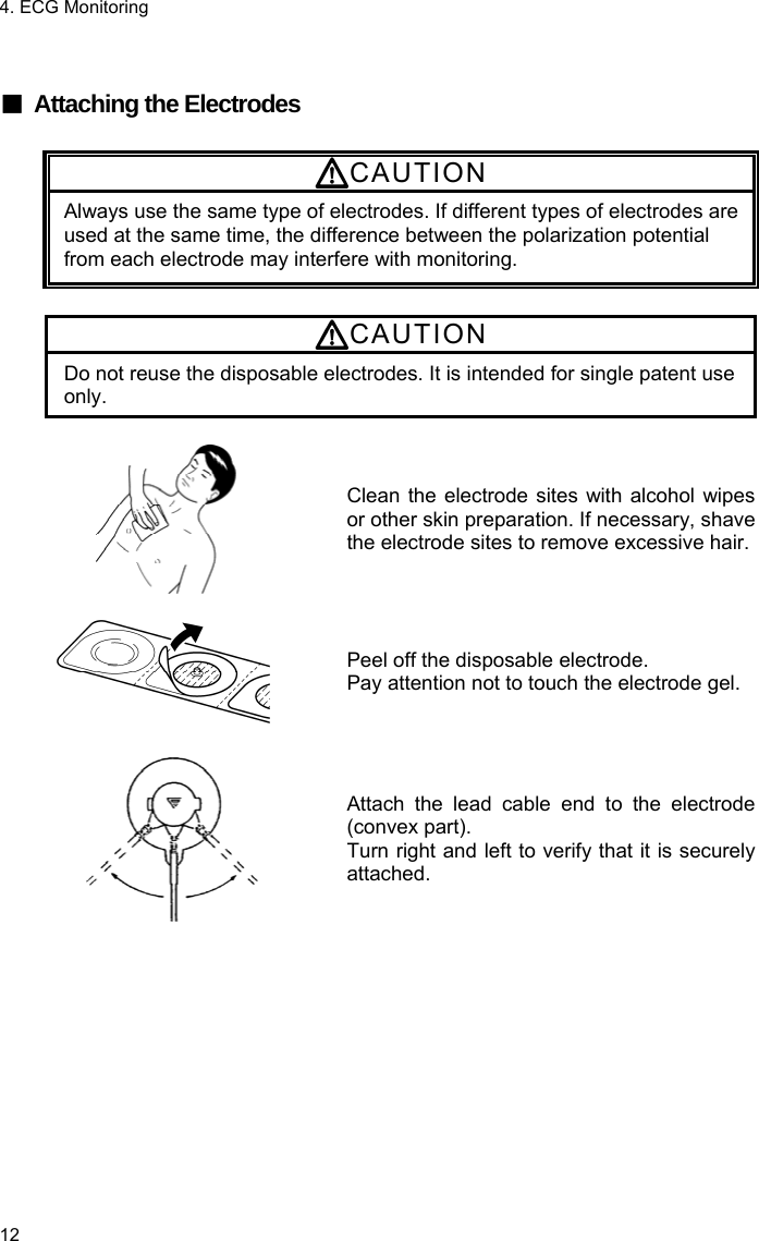 4. ECG Monitoring 12  ■ Attaching the Electrodes  CAUTION Always use the same type of electrodes. If different types of electrodes are used at the same time, the difference between the polarization potential from each electrode may interfere with monitoring.  CAUTION Do not reuse the disposable electrodes. It is intended for single patent use only.   Clean the electrode sites with alcohol wipesor other skin preparation. If necessary, shave the electrode sites to remove excessive hair.   Peel off the disposable electrode. Pay attention not to touch the electrode gel.   Attach the lead cable end to the electrode(convex part). Turn right and left to verify that it is securelyattached.  