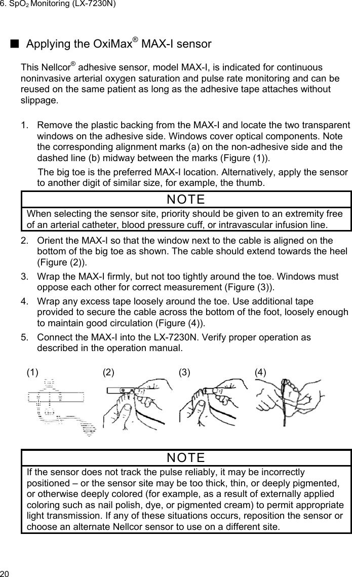 6. SpO2 Monitoring (LX-7230N) 20  ■ Applying the OxiMax® MAX-I sensor  This Nellcor® adhesive sensor, model MAX-I, is indicated for continuous noninvasive arterial oxygen saturation and pulse rate monitoring and can be reused on the same patient as long as the adhesive tape attaches without slippage.  1.  Remove the plastic backing from the MAX-I and locate the two transparent windows on the adhesive side. Windows cover optical components. Note the corresponding alignment marks (a) on the non-adhesive side and the dashed line (b) midway between the marks (Figure (1)). The big toe is the preferred MAX-I location. Alternatively, apply the sensor to another digit of similar size, for example, the thumb. NOTE When selecting the sensor site, priority should be given to an extremity free of an arterial catheter, blood pressure cuff, or intravascular infusion line. 2.  Orient the MAX-I so that the window next to the cable is aligned on the bottom of the big toe as shown. The cable should extend towards the heel (Figure (2)). 3.  Wrap the MAX-I firmly, but not too tightly around the toe. Windows must oppose each other for correct measurement (Figure (3)). 4.  Wrap any excess tape loosely around the toe. Use additional tape provided to secure the cable across the bottom of the foot, loosely enough to maintain good circulation (Figure (4)). 5.  Connect the MAX-I into the LX-7230N. Verify proper operation as described in the operation manual.  (1)  (2)  (3)  (4)  NOTE If the sensor does not track the pulse reliably, it may be incorrectly positioned – or the sensor site may be too thick, thin, or deeply pigmented, or otherwise deeply colored (for example, as a result of externally applied coloring such as nail polish, dye, or pigmented cream) to permit appropriate light transmission. If any of these situations occurs, reposition the sensor or choose an alternate Nellcor sensor to use on a different site.  