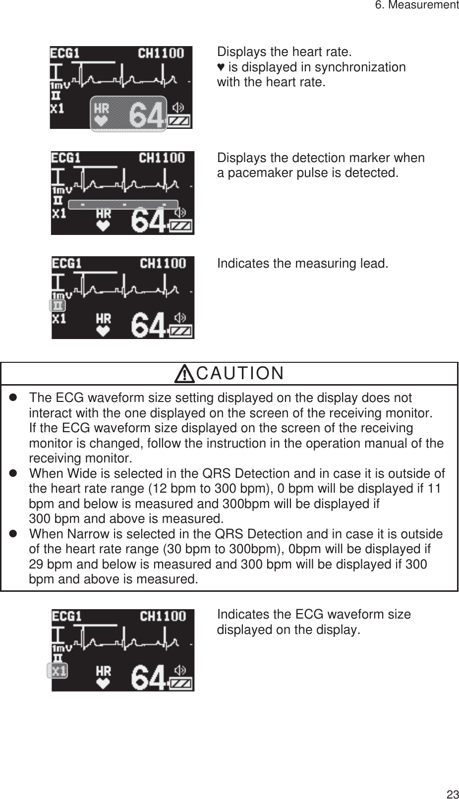 6. Measurement 23        Displays the heart rate.   Ɔ is displayed in synchronization with the heart rate.         Displays the detection marker when a pacemaker pulse is detected.         Indicates the measuring lead.   CAUTION z  The ECG waveform size setting displayed on the display does not interact with the one displayed on the screen of the receiving monitor. If the ECG waveform size displayed on the screen of the receiving monitor is changed, follow the instruction in the operation manual of the receiving monitor. z  When Wide is selected in the QRS Detection and in case it is outside of the heart rate range (12 bpm to 300 bpm), 0 bpm will be displayed if 11 bpm and below is measured and 300bpm will be displayed if   300 bpm and above is measured. z  When Narrow is selected in the QRS Detection and in case it is outside of the heart rate range (30 bpm to 300bpm), 0bpm will be displayed if 29 bpm and below is measured and 300 bpm will be displayed if 300 bpm and above is measured.         Indicates the ECG waveform size displayed on the display.   