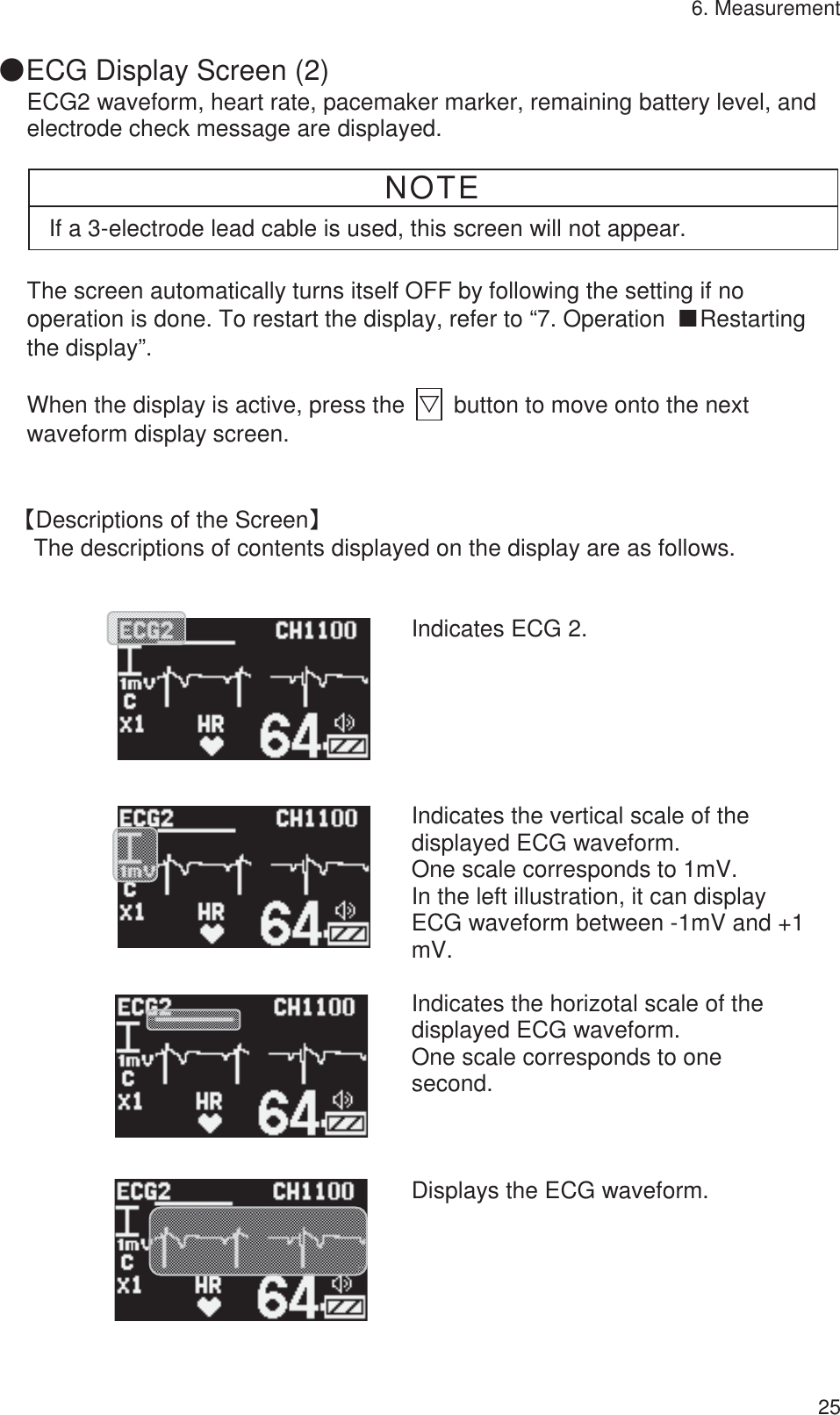 6. Measurement 25 䖃ECG Display Screen (2) ECG2 waveform, heart rate, pacemaker marker, remaining battery level, and electrode check message are displayed.  NOTE If a 3-electrode lead cable is used, this screen will not appear.  The screen automatically turns itself OFF by following the setting if no operation is done. To restart the display, refer to “7. Operation  ŠRestarting the display”.  When the display is active, press the  ť  button to move onto the next waveform display screen.  ࠙Descriptions of the Screenࠚ The descriptions of contents displayed on the display are as follows.         Indicates ECG 2.         Indicates the vertical scale of the displayed ECG waveform. One scale corresponds to 1mV. In the left illustration, it can display ECG waveform between -1mV and +1 mV.         Indicates the horizotal scale of the displayed ECG waveform. One scale corresponds to one second.          Displays the ECG waveform. 