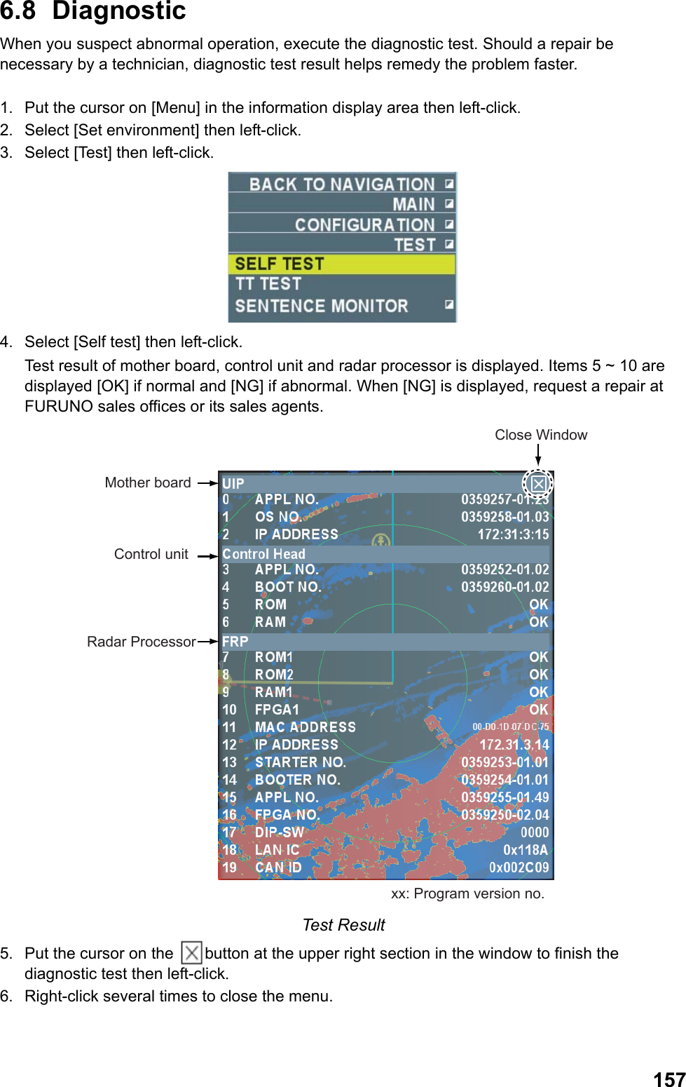  1576.8 Diagnostic  When you suspect abnormal operation, execute the diagnostic test. Should a repair be necessary by a technician, diagnostic test result helps remedy the problem faster.  1.  Put the cursor on [Menu] in the information display area then left-click. 2.  Select [Set environment] then left-click. 3.  Select [Test] then left-click.  4.  Select [Self test] then left-click.  Test result of mother board, control unit and radar processor is displayed. Items 5 ~ 10 are displayed [OK] if normal and [NG] if abnormal. When [NG] is displayed, request a repair at FURUNO sales offices or its sales agents. Close WindowMother boardControl unitRadar Processorxx: Program version no. Test Result 5.  Put the cursor on the  button at the upper right section in the window to finish the diagnostic test then left-click. 6.  Right-click several times to close the menu. 