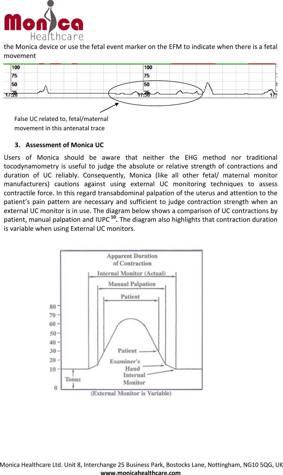 Monica Healthcare Ltd. Unit 8, Interchange 25 Business Park, Bostocks Lane, Nottingham, NG10 5QG, UK www.monicahealthcare.com the Monica device or use the fetal event marker on the EFM to indicate when there is a fetal movement 3. Assessment of Monica UCUsers of Monica should be aware that neither the EHG method nor traditional tocodynamometry is useful to judge the absolute or relative strength of contractions and duration of UC reliably. Consequently, Monica (like all other fetal/ maternal monitor manufacturers) cautions against using external UC monitoring techniques to assess contractile force. In this regard transabdominal palpation of the uterus and attention to the patient’s pain pattern are necessary and sufficient to judge contraction strength when an external UC monitor is in use. The diagram below shows a comparison of UC contractions by patient, manual palpation and IUPC 10. The diagram also highlights that contraction duration is variable when using External UC monitors. False UC related to, fetal/maternal movement in this antenatal trace 