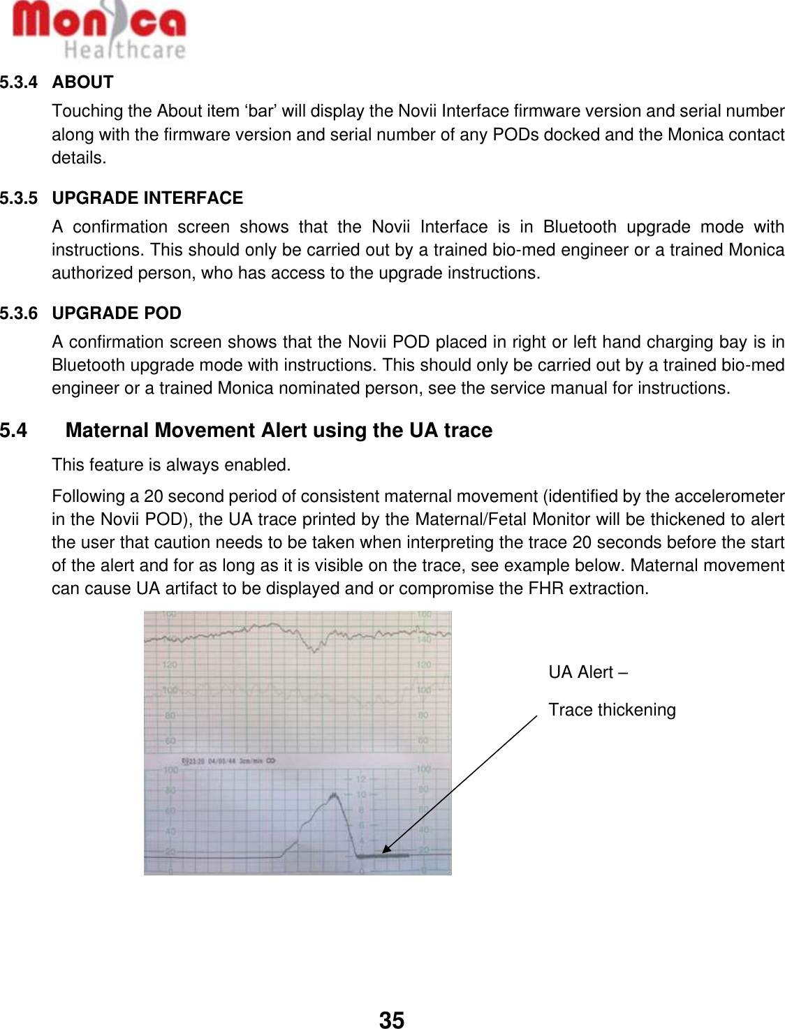   35  5.3.4  ABOUT Touching the About item ‘bar’ will display the Novii Interface firmware version and serial number along with the firmware version and serial number of any PODs docked and the Monica contact details. 5.3.5  UPGRADE INTERFACE  A  confirmation  screen  shows  that  the  Novii  Interface  is  in  Bluetooth  upgrade  mode  with instructions. This should only be carried out by a trained bio-med engineer or a trained Monica authorized person, who has access to the upgrade instructions.  5.3.6  UPGRADE POD A confirmation screen shows that the Novii POD placed in right or left hand charging bay is in Bluetooth upgrade mode with instructions. This should only be carried out by a trained bio-med engineer or a trained Monica nominated person, see the service manual for instructions.  5.4    Maternal Movement Alert using the UA trace This feature is always enabled. Following a 20 second period of consistent maternal movement (identified by the accelerometer in the Novii POD), the UA trace printed by the Maternal/Fetal Monitor will be thickened to alert the user that caution needs to be taken when interpreting the trace 20 seconds before the start of the alert and for as long as it is visible on the trace, see example below. Maternal movement can cause UA artifact to be displayed and or compromise the FHR extraction.           UA Alert –  Trace thickening  