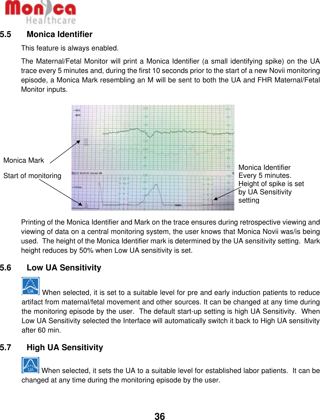   36  5.5    Monica Identifier This feature is always enabled. The Maternal/Fetal Monitor will print a Monica Identifier (a small identifying spike) on the UA trace every 5 minutes and, during the first 10 seconds prior to the start of a new Novii monitoring episode, a Monica Mark resembling an M will be sent to both the UA and FHR Maternal/Fetal Monitor inputs.   Printing of the Monica Identifier and Mark on the trace ensures during retrospective viewing and viewing of data on a central monitoring system, the user knows that Monica Novii was/is being used.  The height of the Monica Identifier mark is determined by the UA sensitivity setting.  Mark height reduces by 50% when Low UA sensitivity is set. 5.6    Low UA Sensitivity    When selected, it is set to a suitable level for pre and early induction patients to reduce artifact from maternal/fetal movement and other sources. It can be changed at any time during the monitoring episode by the user.  The default start-up setting is high UA Sensitivity.  When Low UA Sensitivity selected the Interface will automatically switch it back to High UA sensitivity after 60 min. 5.7    High UA Sensitivity   When selected, it sets the UA to a suitable level for established labor patients.  It can be changed at any time during the monitoring episode by the user.  Monica Identifier   Every 5 minutes.  Height of spike is set by UA Sensitivity setting Monica Mark  Start of monitoring 