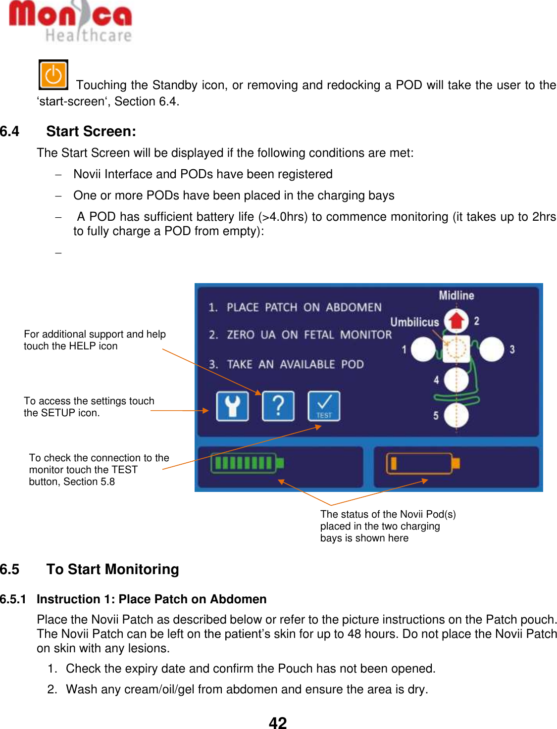   42   Touching the Standby icon, or removing and redocking a POD will take the user to the ‘start-screen‘, Section 6.4.    6.4    Start Screen:  The Start Screen will be displayed if the following conditions are met:   Novii Interface and PODs have been registered   One or more PODs have been placed in the charging bays     A POD has sufficient battery life (&gt;4.0hrs) to commence monitoring (it takes up to 2hrs to fully charge a POD from empty):                  6.5    To Start Monitoring 6.5.1  Instruction 1: Place Patch on Abdomen Place the Novii Patch as described below or refer to the picture instructions on the Patch pouch. The Novii Patch can be left on the patient’s skin for up to 48 hours. Do not place the Novii Patch on skin with any lesions.  1.  Check the expiry date and confirm the Pouch has not been opened.   2.  Wash any cream/oil/gel from abdomen and ensure the area is dry.    To check the connection to the monitor touch the TEST button, Section 5.8 To access the settings touch the SETUP icon.  The status of the Novii Pod(s) placed in the two charging bays is shown here For additional support and help touch the HELP icon  