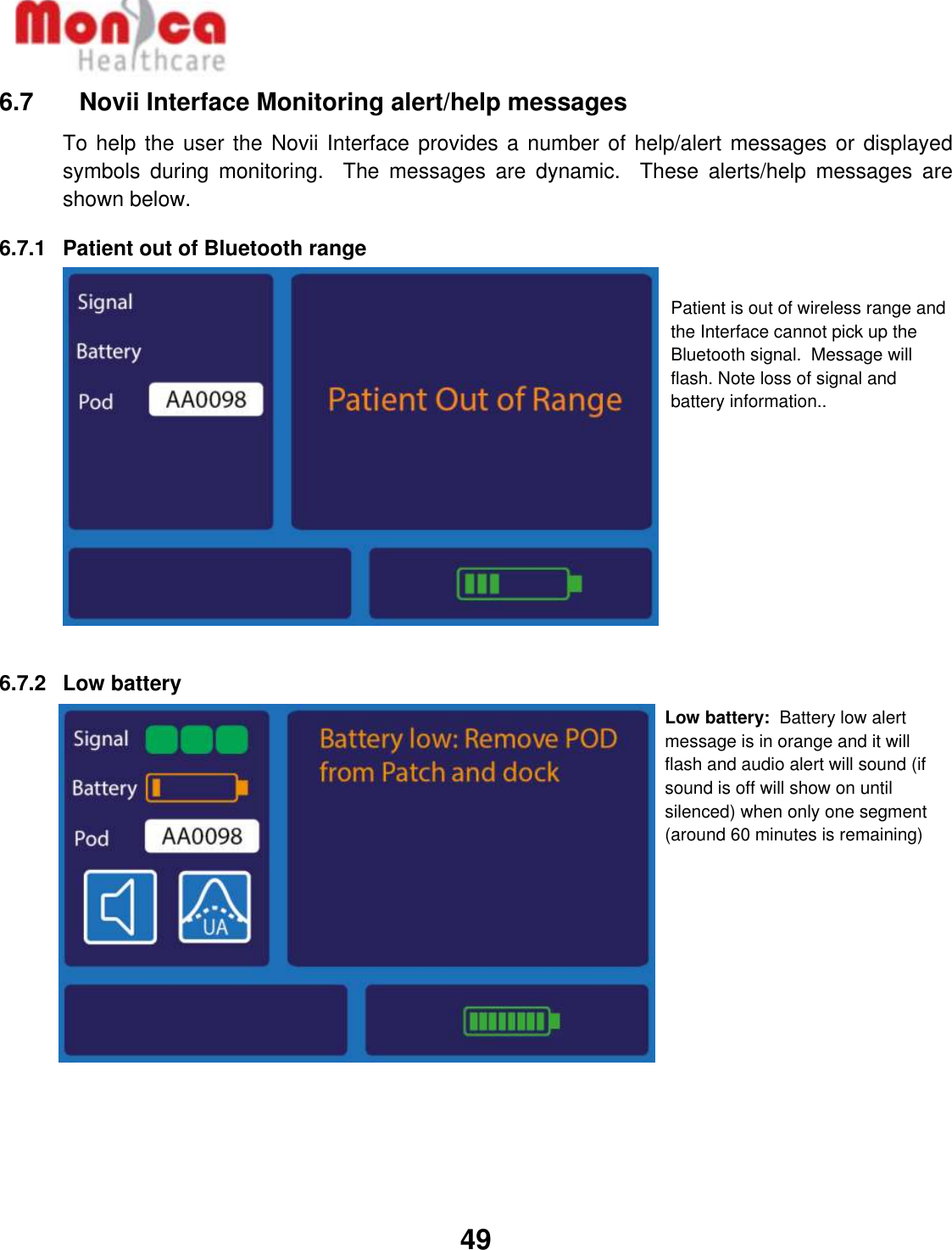   49  6.7    Novii Interface Monitoring alert/help messages To help the user the Novii Interface provides a number of help/alert messages or displayed symbols  during  monitoring.    The  messages  are  dynamic.    These  alerts/help  messages  are shown below. 6.7.1  Patient out of Bluetooth range            6.7.2  Low battery            Low battery:  Battery low alert message is in orange and it will flash and audio alert will sound (if sound is off will show on until silenced) when only one segment (around 60 minutes is remaining) Patient is out of wireless range and the Interface cannot pick up the Bluetooth signal.  Message will flash. Note loss of signal and battery information.. Patient out of range 