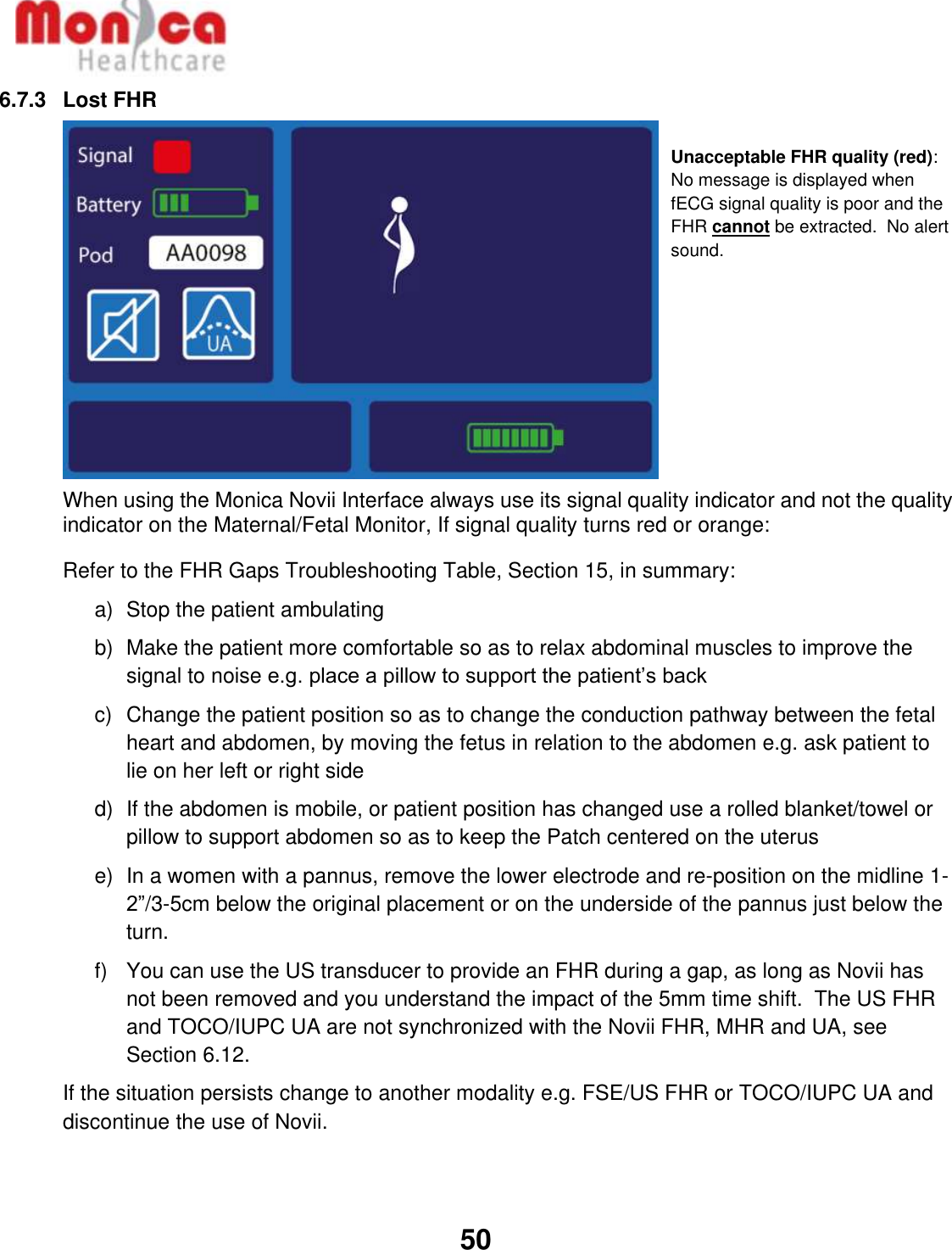   50  6.7.3  Lost FHR           When using the Monica Novii Interface always use its signal quality indicator and not the quality indicator on the Maternal/Fetal Monitor, If signal quality turns red or orange: Refer to the FHR Gaps Troubleshooting Table, Section 15, in summary: a)  Stop the patient ambulating b)  Make the patient more comfortable so as to relax abdominal muscles to improve the signal to noise e.g. place a pillow to support the patient’s back c)  Change the patient position so as to change the conduction pathway between the fetal heart and abdomen, by moving the fetus in relation to the abdomen e.g. ask patient to lie on her left or right side d)  If the abdomen is mobile, or patient position has changed use a rolled blanket/towel or pillow to support abdomen so as to keep the Patch centered on the uterus e)  In a women with a pannus, remove the lower electrode and re-position on the midline 1-2”/3-5cm below the original placement or on the underside of the pannus just below the turn. f)  You can use the US transducer to provide an FHR during a gap, as long as Novii has not been removed and you understand the impact of the 5mm time shift.  The US FHR and TOCO/IUPC UA are not synchronized with the Novii FHR, MHR and UA, see Section 6.12. If the situation persists change to another modality e.g. FSE/US FHR or TOCO/IUPC UA and discontinue the use of Novii.  Unacceptable FHR quality (red):  No message is displayed when fECG signal quality is poor and the FHR cannot be extracted.  No alert sound.   