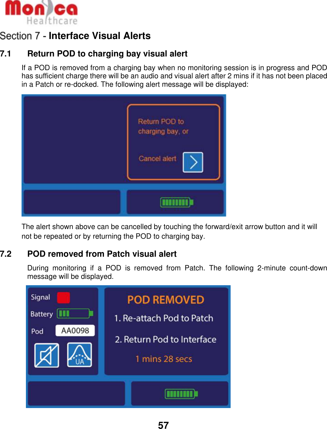   57  Interface Visual Alerts 7.1    Return POD to charging bay visual alert If a POD is removed from a charging bay when no monitoring session is in progress and POD has sufficient charge there will be an audio and visual alert after 2 mins if it has not been placed in a Patch or re-docked. The following alert message will be displayed:                 The alert shown above can be cancelled by touching the forward/exit arrow button and it will not be repeated or by returning the POD to charging bay. 7.2    POD removed from Patch visual alert During  monitoring  if  a  POD  is  removed  from  Patch.  The  following  2-minute  count-down message will be displayed.           