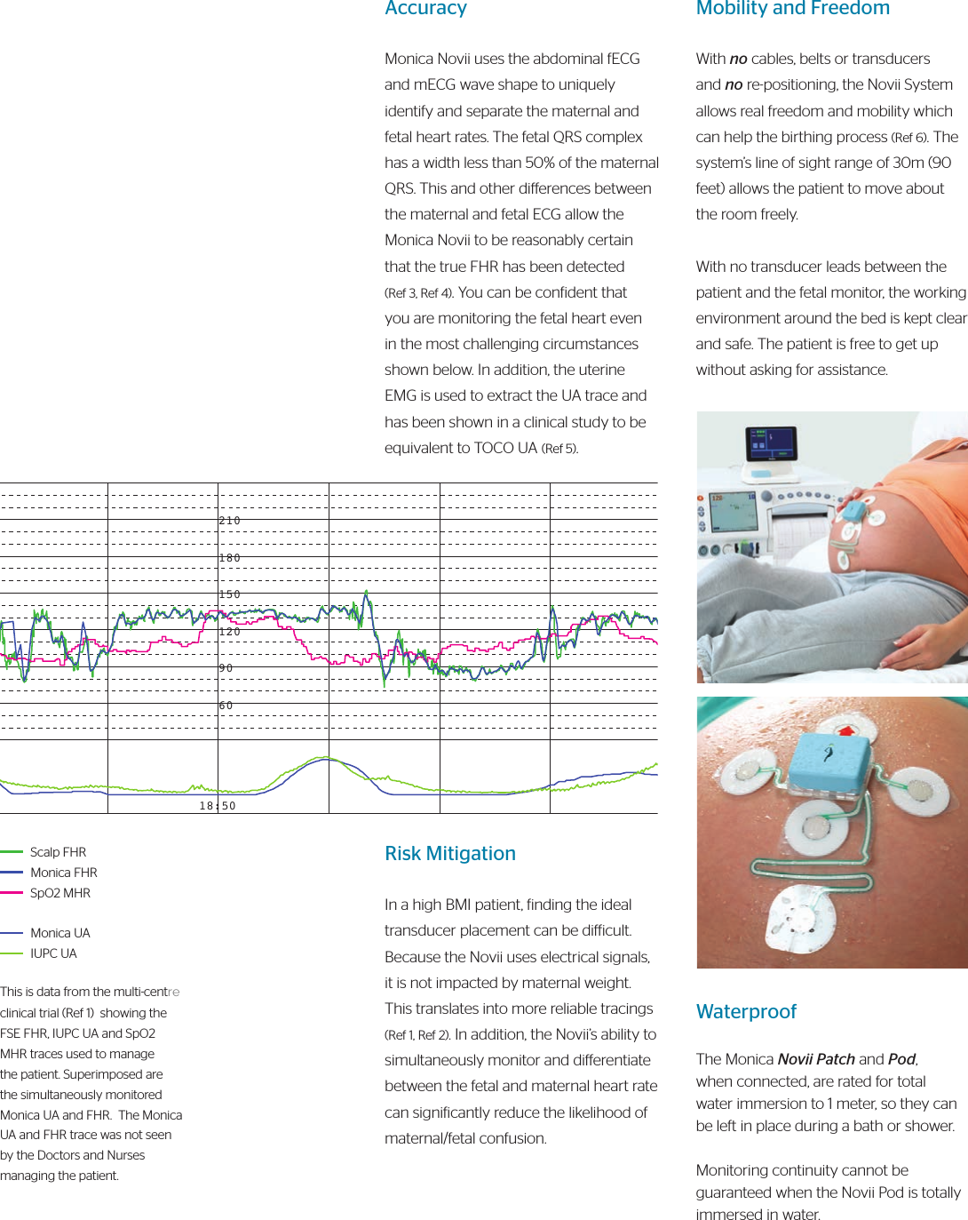 Mobility and FreedomWith no cables, belts or transducers and no re-positioning, the Novii System allows real freedom and mobility which can help the birthing process (Ref 6). The system’s line of sight range of 30m (90 feet) allows the patient to move about the room freely.With no transducer leads between the patient and the fetal monitor, the working environment around the bed is kept clear and safe. The patient is free to get up without asking for assistance.  WaterproofThe Monica Novii Patch and Pod, when connected, are rated for total water immersion to 1 meter, so they can be left in place during a bath or shower.  Monitoring continuity cannot be guaranteed when the Novii Pod is totally immersed in water.210180150120906018:50Risk MitigationIn a high BMI patient, inding the ideal transducer placement can be diicult.  Because the Novii uses electrical signals, it is not impacted by maternal weight. This translates into more reliable tracings (Ref 1, Ref 2). In addition, the Novii’s ability to simultaneously monitor and dierentiate between the fetal and maternal heart rate can signiicantly reduce the likelihood of maternal/fetal confusion.AccuracyMonica Novii uses the abdominal fECG and mECG wave shape to uniquely identify and separate the maternal and fetal heart rates. The fetal QRS complex has a width less than 50% of the maternal QRS. This and other dierences between the maternal and fetal ECG allow the Monica Novii to be reasonably certain that the true FHR has been detected  (Ref 3, Ref 4). You can be conident that you are monitoring the fetal heart even in the most challenging circumstances shown below. In addition, the uterine EMG is used to extract the UA trace and has been shown in a clinical study to be equivalent to TOCO UA (Ref 5).Scalp FHRMonica FHRSpO2 MHRMonica UAIUPC UAThis is data from the multi-centre clinical trial (Ref 1)  showing the FSE FHR, IUPC UA and SpO2 MHR traces used to manage the patient. Superimposed are the simultaneously monitored Monica UA and FHR.  The Monica UA and FHR trace was not seen by the Doctors and Nurses managing the patient. 