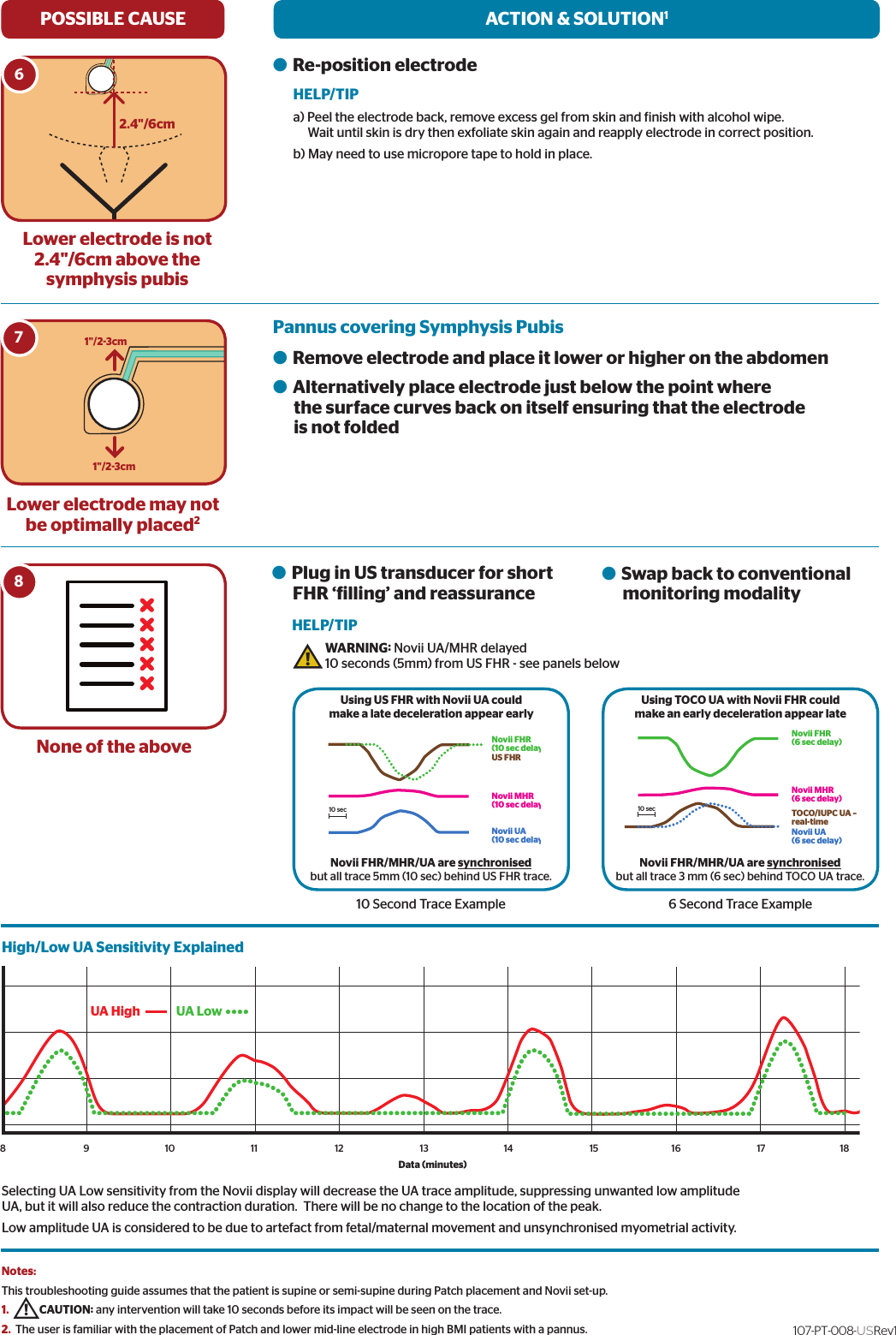 SKIN PREPARATION GOODREPEAT SKIN PREPREPEAT SKIN PREPDO NOT BYPASS2.4&quot;/6cm1&quot;/2-3cm1&quot;/2-3cmFHRMHRUA6Lower electrode is not 2.4&quot;/6cm above the symphysis pubisPOSSIBLE CAUSE ACTION &amp; SOLUTION1HELP/TIPLower electrode may not be optimally placed2SKIN PREPARATION GOODREPEAT SKIN PREPREPEAT SKIN PREPDO NOT BYPASS2.4&quot;/6cm1&quot;/2-3cm1&quot;/2-3cmFHRMHRUA7SKIN PREPARATION GOODREPEAT SKIN PREPREPEAT SKIN PREPDO NOT BYPASS2.4&quot;/6cm1&quot;/2-3cm1&quot;/2-3cmFHRMHRUA8None of the abovel Re-position electrode a) Peel the electrode back, remove excess gel from skin and inish with alcohol wipe.Wait until skin is dry then exfoliate skin again and reapply electrode in correct position.b) May need to use micropore tape to hold in place.l Remove electrode and place it lower or higher on the abdomen l Alternatively place electrode just below the point where       the surface curves back on itself ensuring that the electrode       is not foldedl Plug in US transducer for short       FHR ‘illing’ and reassuranceWARNING: Novii UA/MHR delayed 10 seconds (5mm) from US FHR - see panels belowHELP/TIPl Swap back to conventional       monitoring modality10 Second Trace ExampleNotes: This troubleshooting guide assumes that the patient is supine or semi-supine during Patch placement and Novii set-up.1.     CAUTION: any intervention will take 10 seconds before its impact will be seen on the trace.2. The user is familiar with the placement of Patch and lower mid-line electrode in high BMI patients with a pannus.!!6 Second Trace ExampleHigh/Low UA Sensitivity ExplainedSelecting UA Low sensitivity from the Novii display will decrease the UA trace amplitude, suppressing unwanted low amplitude UA, but it will also reduce the contraction duration.  There will be no change to the location of the peak.Low amplitude UA is considered to be due to artefact from fetal/maternal movement and unsynchronised myometrial activity.  Using US FHR with Novii UA could make a late deceleration appear earlyNovii FHR/MHR/UA are synchronised but all trace 5mm (10 sec) behind US FHR trace.Using TOCO UA with Novii FHR could make an early deceleration appear lateNovii FHR/MHR/UA are synchronised but all trace 3 mm (6 sec) behind TOCO UA trace.Novii FHR(6 sec delay)Novii MHR(6 sec delay)TOCO/IUPC UA –real-timeNovii UA(6 sec delay)10 secNovii FHR(10 sec delay)US FHRNovii MHR(10 sec delay)Novii UA(10 sec delay)10 secNovii FHR(6 sec delay)Novii MHR(6 sec delay)TOCO/IUPC UA –real-timeNovii UA(6 sec delay)10 secNovii FHR(10 sec delay)US FHRNovii MHR(10 sec delay)Novii UA(10 sec delay)10 secUA High8 9 10 11 18171615141312UA LowData (minutes)Pannus covering Symphysis Pubis 107-PT-008-USRev1