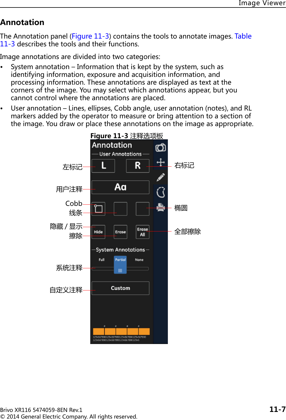 ImageViewerBrivoXR1165474059-8ENRev.1 11-7©2014GeneralElectricCompany.Allrightsreserved.AnnotationTheAnnotationpanel(Figure11-3)containsthetoolstoannotateimages.Table11-3describesthetoolsandtheirfunctions.Imageannotationsaredividedintotwocategories:• Systemannotation–Informationthatiskeptbythesystem,suchasidentifyinginformation,exposureandacquisitioninformation,andprocessinginformation.Theseannotationsaredisplayedastextatthecornersoftheimage.Youmayselectwhichannotationsappear,butyoucannotcontrolwheretheannotationsareplaced.• Userannotation–Lines,ellipses,Cobbangle,userannotation(notes),andRLmarkersaddedbytheoperatortomeasureorbringattentiontoasectionoftheimage.Youdraworplacetheseannotationsontheimageasappropriate.Figure11-3注释选项板左标记 右标记用户注释Cobb线条隐藏 / 显示擦除系统注释自定义注释椭圆全部擦除