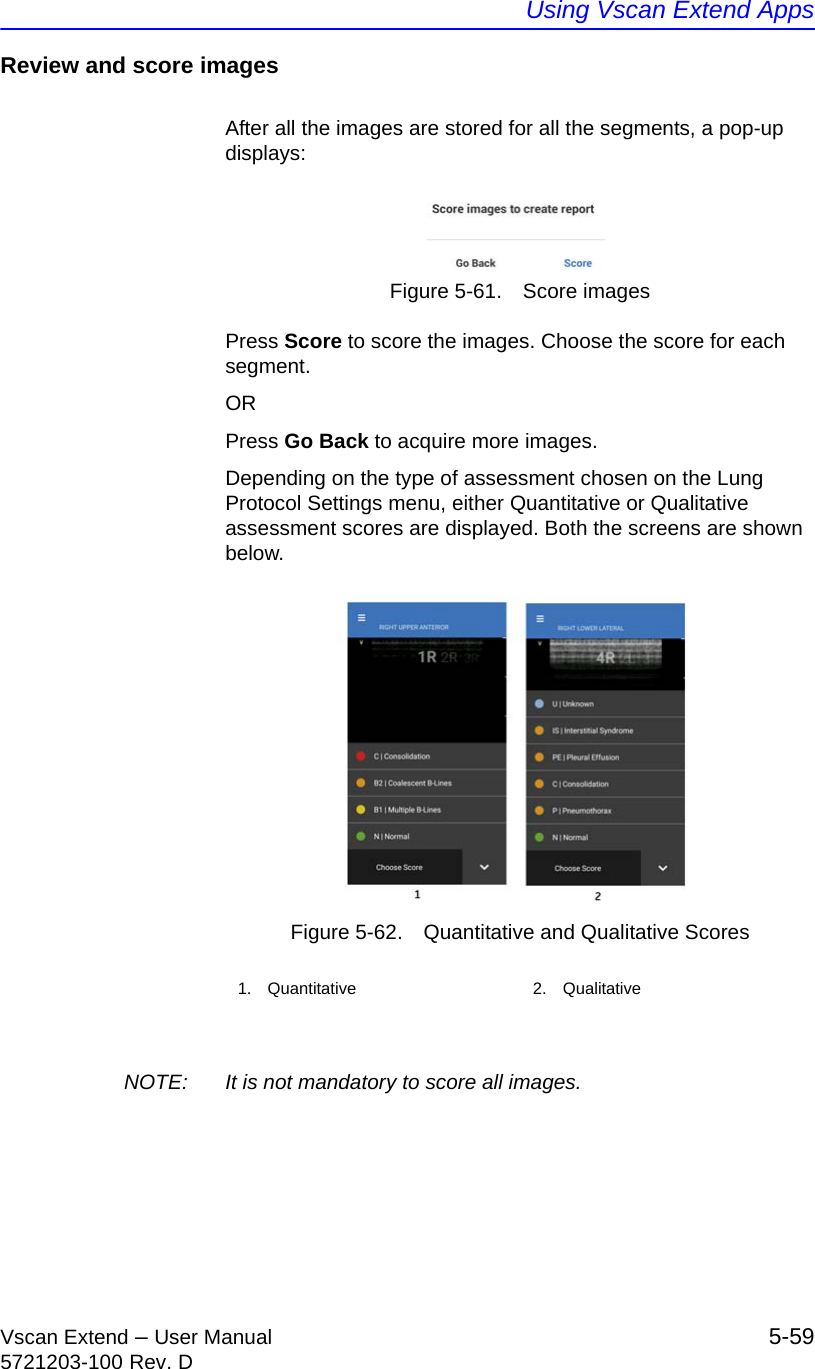 Using Vscan Extend AppsVscan Extend – User Manual 5-595721203-100 Rev. DReview and score imagesAfter all the images are stored for all the segments, a pop-up displays:Figure 5-61. Score imagesPress Score to score the images. Choose the score for each segment.ORPress Go Back to acquire more images.Depending on the type of assessment chosen on the Lung Protocol Settings menu, either Quantitative or Qualitative assessment scores are displayed. Both the screens are shown below.Figure 5-62. Quantitative and Qualitative ScoresNOTE:  It is not mandatory to score all images.1. Quantitative 2. Qualitative