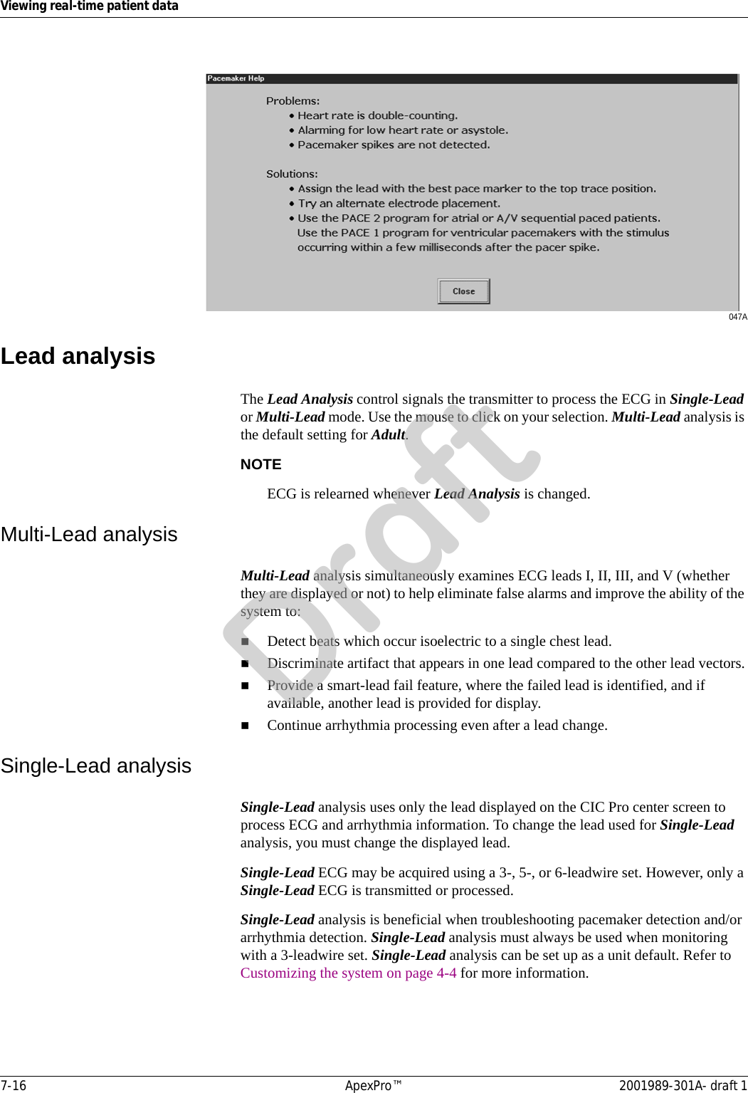 7-16 ApexPro™ 2001989-301A- draft 1Viewing real-time patient data047ALead analysisThe Lead Analysis control signals the transmitter to process the ECG in Single-Lead or Multi-Lead mode. Use the mouse to click on your selection. Multi-Lead analysis is the default setting for Adult.NOTEECG is relearned whenever Lead Analysis is changed.Multi-Lead analysisMulti-Lead analysis simultaneously examines ECG leads I, II, III, and V (whether they are displayed or not) to help eliminate false alarms and improve the ability of the system to:Detect beats which occur isoelectric to a single chest lead.Discriminate artifact that appears in one lead compared to the other lead vectors.Provide a smart-lead fail feature, where the failed lead is identified, and if available, another lead is provided for display.Continue arrhythmia processing even after a lead change.Single-Lead analysisSingle-Lead analysis uses only the lead displayed on the CIC Pro center screen to process ECG and arrhythmia information. To change the lead used for Single-Lead analysis, you must change the displayed lead. Single-Lead ECG may be acquired using a 3-, 5-, or 6-leadwire set. However, only a Single-Lead ECG is transmitted or processed.Single-Lead analysis is beneficial when troubleshooting pacemaker detection and/or arrhythmia detection. Single-Lead analysis must always be used when monitoring with a 3-leadwire set. Single-Lead analysis can be set up as a unit default. Refer to Customizing the system on page 4-4 for more information.Draft