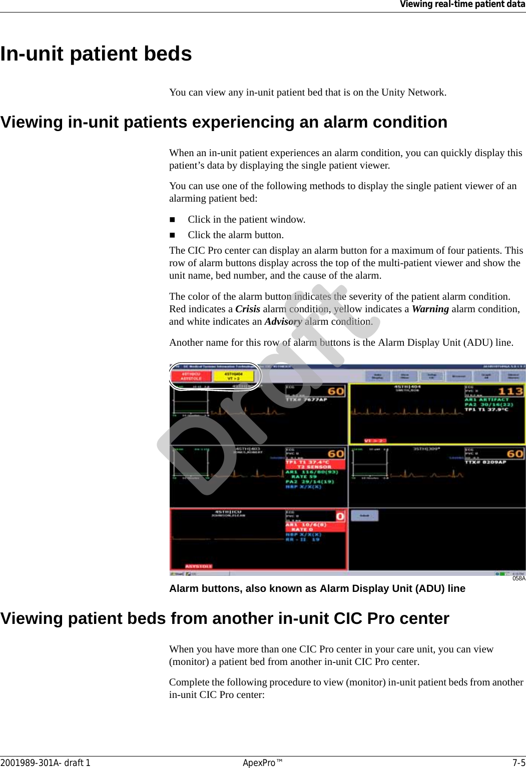 Viewing real-time patient data2001989-301A- draft 1 ApexPro™ 7-5In-unit patient bedsYou can view any in-unit patient bed that is on the Unity Network.Viewing in-unit patients experiencing an alarm conditionWhen an in-unit patient experiences an alarm condition, you can quickly display this patient’s data by displaying the single patient viewer. You can use one of the following methods to display the single patient viewer of an alarming patient bed:Click in the patient window.Click the alarm button.The CIC Pro center can display an alarm button for a maximum of four patients. This row of alarm buttons display across the top of the multi-patient viewer and show the unit name, bed number, and the cause of the alarm. The color of the alarm button indicates the severity of the patient alarm condition. Red indicates a Crisis alarm condition, yellow indicates a Warning alarm condition, and white indicates an Advisory alarm condition.Another name for this row of alarm buttons is the Alarm Display Unit (ADU) line.058AAlarm buttons, also known as Alarm Display Unit (ADU) lineViewing patient beds from another in-unit CIC Pro centerWhen you have more than one CIC Pro center in your care unit, you can view (monitor) a patient bed from another in-unit CIC Pro center.Complete the following procedure to view (monitor) in-unit patient beds from another in-unit CIC Pro center:Draft