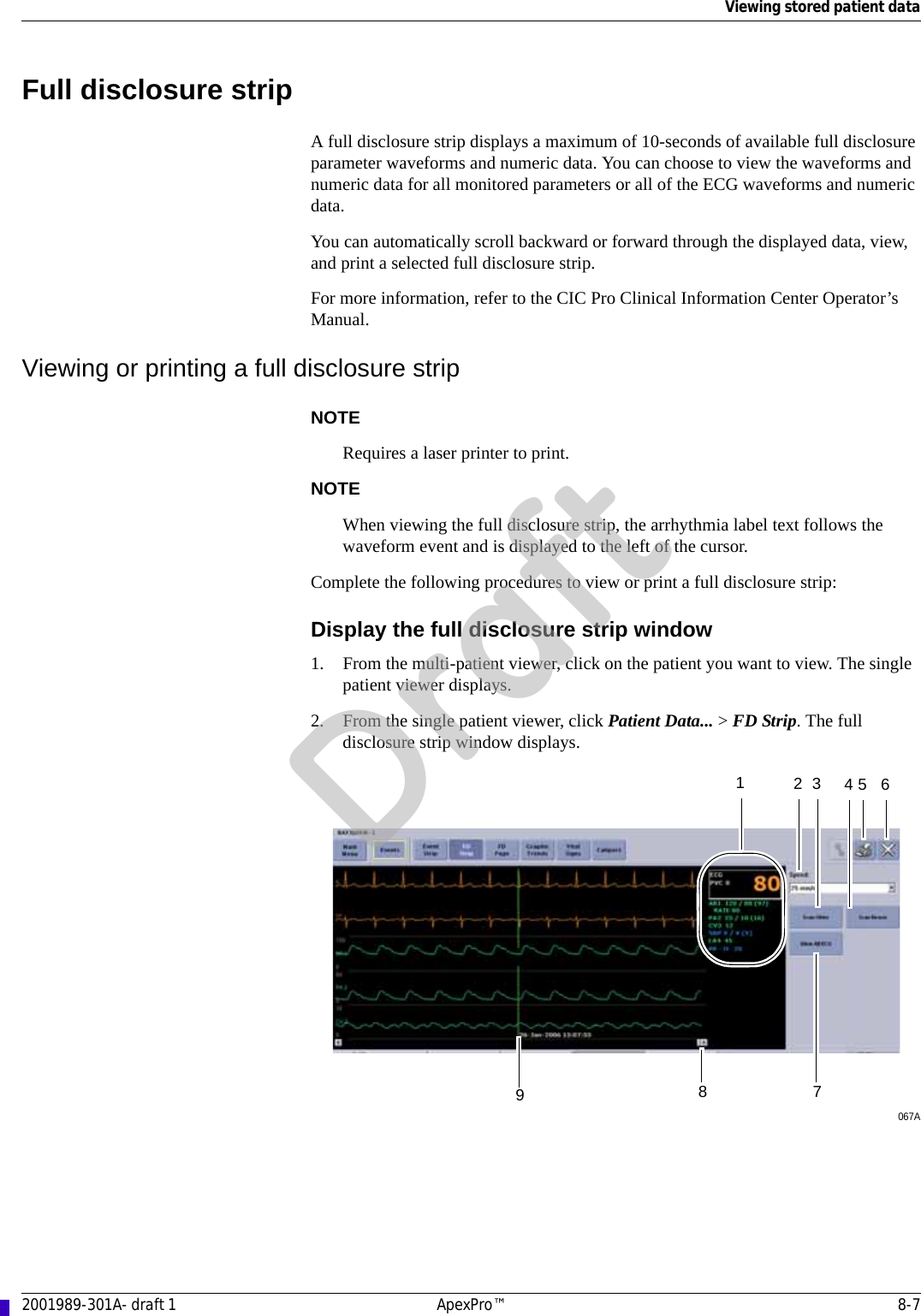 Viewing stored patient data2001989-301A- draft 1 ApexPro™ 8-7Full disclosure stripA full disclosure strip displays a maximum of 10-seconds of available full disclosure parameter waveforms and numeric data. You can choose to view the waveforms and numeric data for all monitored parameters or all of the ECG waveforms and numeric data. You can automatically scroll backward or forward through the displayed data, view, and print a selected full disclosure strip. For more information, refer to the CIC Pro Clinical Information Center Operator’s Manual.Viewing or printing a full disclosure stripNOTERequires a laser printer to print.NOTEWhen viewing the full disclosure strip, the arrhythmia label text follows the waveform event and is displayed to the left of the cursor.Complete the following procedures to view or print a full disclosure strip:Display the full disclosure strip window1. From the multi-patient viewer, click on the patient you want to view. The single patient viewer displays. 2. From the single patient viewer, click Patient Data... &gt; FD Strip. The full disclosure strip window displays.067A8195 62347Draft