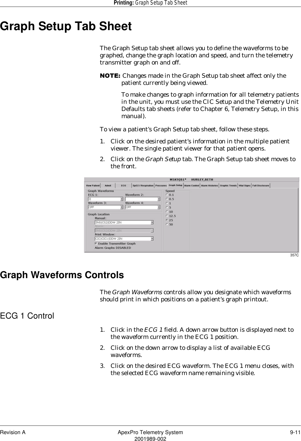 Revision A ApexPro Telemetry System 9-112001989-002Printing: Graph Setup Tab SheetGraph Setup Tab SheetThe Graph Setup tab sheet allows you to define the waveforms to be graphed, change the graph location and speed, and turn the telemetry transmitter graph on and off. 127(Changes made in the Graph Setup tab sheet affect only the patient currently being viewed. To make changes to graph information for all telemetry patients in the unit, you must use the CIC Setup and the Telemetry Unit Defaults tab sheets (refer to Chapter 6, Telemetry Setup, in this manual).To view a patient’s Graph Setup tab sheet, follow these steps.1. Click on the desired patient’s information in the multiple patient viewer. The single patient viewer for that patient opens.2. Click on the Graph Setup tab. The Graph Setup tab sheet moves to the front.Graph Waveforms ControlsThe Graph Waveforms controls allow you designate which waveforms should print in which positions on a patient’s graph printout.ECG 1 Control1. Click in the ECG 1 field. A down arrow button is displayed next to the waveform currently in the ECG 1 position.2. Click on the down arrow to display a list of available ECG waveforms.3. Click on the desired ECG waveform. The ECG 1 menu closes, with the selected ECG waveform name remaining visible.