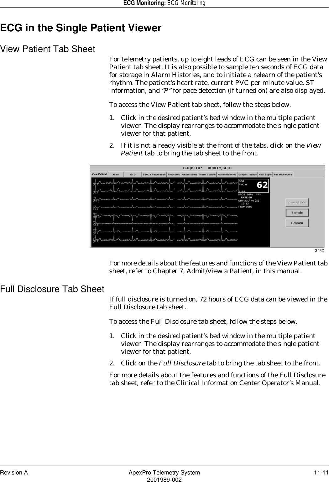 Revision A ApexPro Telemetry System 11-112001989-002ECG Monitoring: ECG MonitoringECG in the Single Patient ViewerView Patient Tab Sheet For telemetry patients, up to eight leads of ECG can be seen in the View Patient tab sheet. It is also possible to sample ten seconds of ECG data for storage in Alarm Histories, and to initiate a relearn of the patient’s rhythm. The patient’s heart rate, current PVC per minute value, ST information, and “P” for pace detection (if turned on) are also displayed.To access the View Patient tab sheet, follow the steps below.1. Click in the desired patient’s bed window in the multiple patient viewer. The display rearranges to accommodate the single patient viewer for that patient.2. If it is not already visible at the front of the tabs, click on the View Patient tab to bring the tab sheet to the front.For more details about the features and functions of the View Patient tab sheet, refer to Chapter 7, Admit/View a Patient, in this manual.Full Disclosure Tab Sheet If full disclosure is turned on, 72 hours of ECG data can be viewed in the Full Disclosure tab sheet.To access the Full Disclosure tab sheet, follow the steps below.1. Click in the desired patient’s bed window in the multiple patient viewer. The display rearranges to accommodate the single patient viewer for that patient.2. Click on the Full Disclosure tab to bring the tab sheet to the front.For more details about the features and functions of the Full Disclosure tab sheet, refer to the Clinical Information Center Operator’s Manual.
