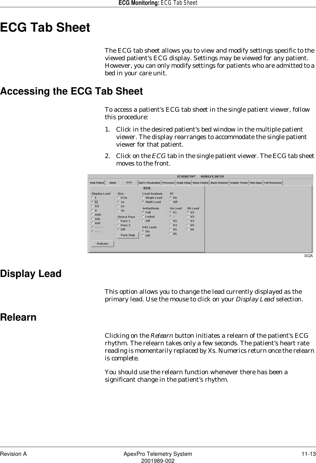 Revision A ApexPro Telemetry System 11-132001989-002ECG Monitoring: ECG Tab SheetECG Tab SheetThe ECG tab sheet allows you to view and modify settings specific to the viewed patient’s ECG display. Settings may be viewed for any patient. However, you can only modify settings for patients who are admitted to a bed in your care unit.Accessing the ECG Tab SheetTo access a patient’s ECG tab sheet in the single patient viewer, follow this procedure:1. Click in the desired patient’s bed window in the multiple patient viewer. The display rearranges to accommodate the single patient viewer for that patient.2. Click on the ECG tab in the single patient viewer. The ECG tab sheet moves to the front.Display LeadThis option allows you to change the lead currently displayed as the primary lead. Use the mouse to click on your Display Lead selection.RelearnClicking on the Relearn button initiates a relearn of the patient’s ECG rhythm. The relearn takes only a few seconds. The patient’s heart rate reading is momentarily replaced by Xs. Numerics return once the relearn is complete. You should use the relearn function whenever there has been a significant change in the patient’s rhythm.