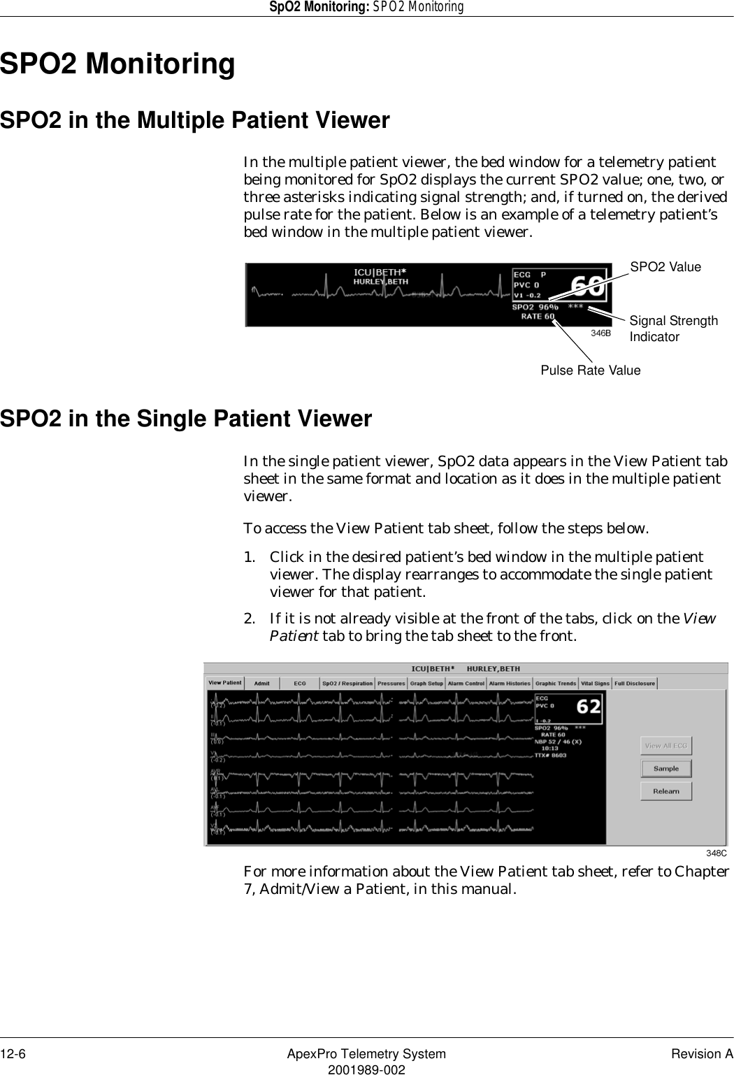 12-6 ApexPro Telemetry System Revision A2001989-002SpO2 Monitoring: SPO2 MonitoringSPO2 MonitoringSPO2 in the Multiple Patient ViewerIn the multiple patient viewer, the bed window for a telemetry patient being monitored for SpO2 displays the current SPO2 value; one, two, or three asterisks indicating signal strength; and, if turned on, the derived pulse rate for the patient. Below is an example of a telemetry patient’s bed window in the multiple patient viewer.SPO2 in the Single Patient ViewerIn the single patient viewer, SpO2 data appears in the View Patient tab sheet in the same format and location as it does in the multiple patient viewer.To access the View Patient tab sheet, follow the steps below.1. Click in the desired patient’s bed window in the multiple patient viewer. The display rearranges to accommodate the single patient viewer for that patient.2. If it is not already visible at the front of the tabs, click on the View Patient tab to bring the tab sheet to the front.For more information about the View Patient tab sheet, refer to Chapter 7, Admit/View a Patient, in this manual.Signal Strength IndicatorSPO2 ValuePulse Rate Value