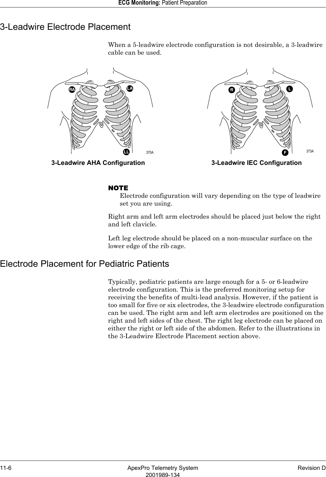 11-6 ApexPro Telemetry System Revision D2001989-134ECG Monitoring: Patient Preparation3-Leadwire Electrode PlacementWhen a 5-leadwire electrode configuration is not desirable, a 3-leadwire cable can be used.NOTEElectrode configuration will vary depending on the type of leadwire set you are using.Right arm and left arm electrodes should be placed just below the right and left clavicle.Left leg electrode should be placed on a non-muscular surface on the lower edge of the rib cage.Electrode Placement for Pediatric PatientsTypically, pediatric patients are large enough for a 5- or 6-leadwire electrode configuration. This is the preferred monitoring setup for receiving the benefits of multi-lead analysis. However, if the patient is too small for five or six electrodes, the 3-leadwire electrode configuration can be used. The right arm and left arm electrodes are positioned on the right and left sides of the chest. The right leg electrode can be placed on either the right or left side of the abdomen. Refer to the illustrations in the 3-Leadwire Electrode Placement section above.RLFRA LALL3-Leadwire AHA Configuration 3-Leadwire IEC Configuration 370A  373A