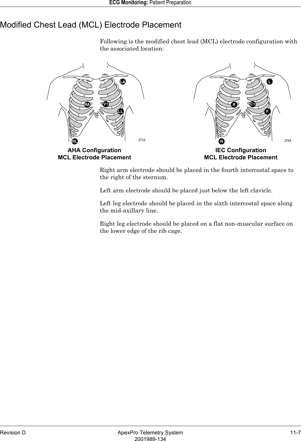 Revision D ApexPro Telemetry System 11-72001989-134ECG Monitoring: Patient PreparationModified Chest Lead (MCL) Electrode PlacementFollowing is the modified chest lead (MCL) electrode configuration with the associated location:Right arm electrode should be placed in the fourth intercostal space to the right of the sternum.Left arm electrode should be placed just below the left clavicle.Left leg electrode should be placed in the sixth intercostal space along the mid-axillary line.Right leg electrode should be placed on a flat non-muscular surface on the lower edge of the rib cage.RLC1F NRALAV1LL RLAHA Configuration MCL Electrode PlacementIEC Configuration MCL Electrode Placement 371A  375A