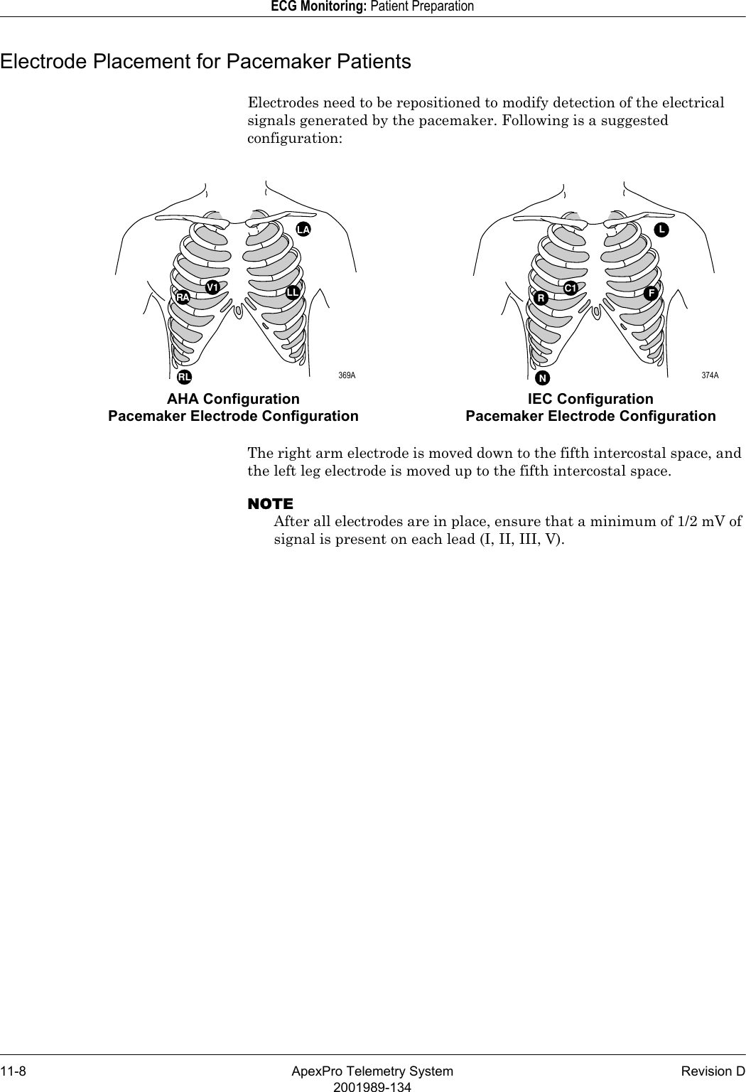 11-8 ApexPro Telemetry System Revision D2001989-134ECG Monitoring: Patient PreparationElectrode Placement for Pacemaker PatientsElectrodes need to be repositioned to modify detection of the electrical signals generated by the pacemaker. Following is a suggested configuration:The right arm electrode is moved down to the fifth intercostal space, and the left leg electrode is moved up to the fifth intercostal space.NOTEAfter all electrodes are in place, ensure that a minimum of 1/2 mV of signal is present on each lead (I, II, III, V).LC1RFNRALAV1 LL RLAHA Configuration Pacemaker Electrode ConfigurationIEC Configuration Pacemaker Electrode Configuration 369A  374A