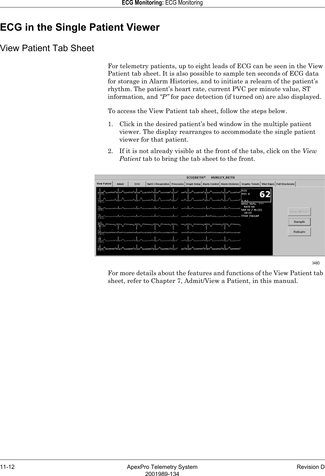 11-12 ApexPro Telemetry System Revision D2001989-134ECG Monitoring: ECG MonitoringECG in the Single Patient ViewerView Patient Tab SheetFor telemetry patients, up to eight leads of ECG can be seen in the View Patient tab sheet. It is also possible to sample ten seconds of ECG data for storage in Alarm Histories, and to initiate a relearn of the patient’s rhythm. The patient’s heart rate, current PVC per minute value, ST information, and “P” for pace detection (if turned on) are also displayed.To access the View Patient tab sheet, follow the steps below.1. Click in the desired patient’s bed window in the multiple patient viewer. The display rearranges to accommodate the single patient viewer for that patient.2. If it is not already visible at the front of the tabs, click on the View Patient tab to bring the tab sheet to the front.For more details about the features and functions of the View Patient tab sheet, refer to Chapter 7, Admit/View a Patient, in this manual. 348D