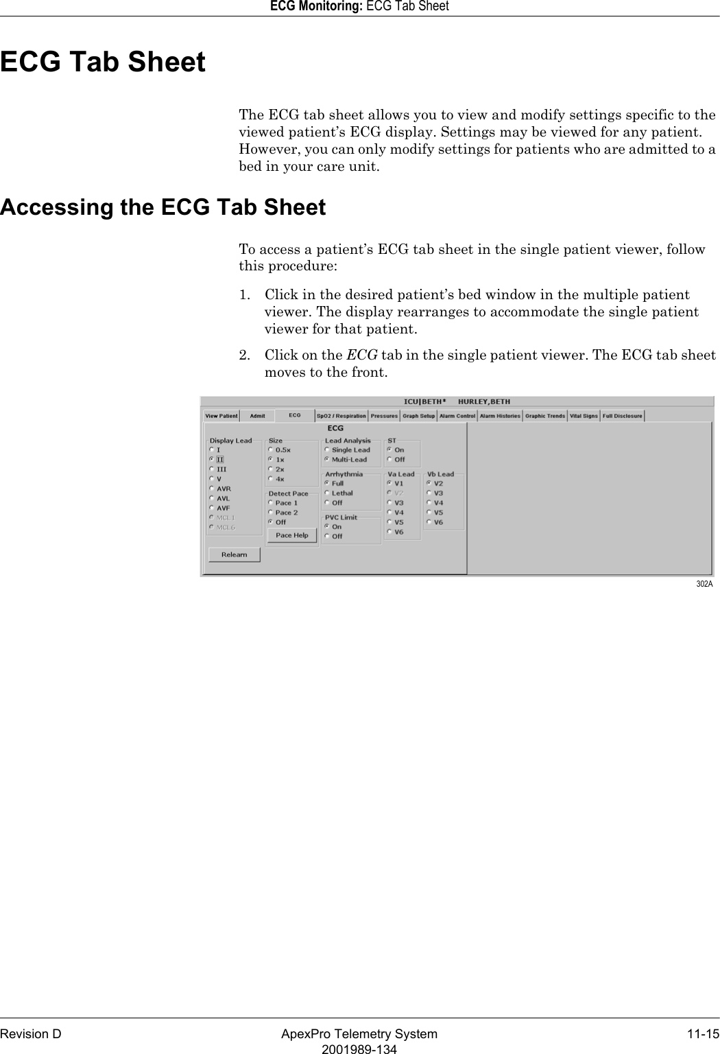 Revision D ApexPro Telemetry System 11-152001989-134ECG Monitoring: ECG Tab SheetECG Tab SheetThe ECG tab sheet allows you to view and modify settings specific to the viewed patient’s ECG display. Settings may be viewed for any patient. However, you can only modify settings for patients who are admitted to a bed in your care unit.Accessing the ECG Tab SheetTo access a patient’s ECG tab sheet in the single patient viewer, follow this procedure:1. Click in the desired patient’s bed window in the multiple patient viewer. The display rearranges to accommodate the single patient viewer for that patient.2. Click on the ECG tab in the single patient viewer. The ECG tab sheet moves to the front. 302A