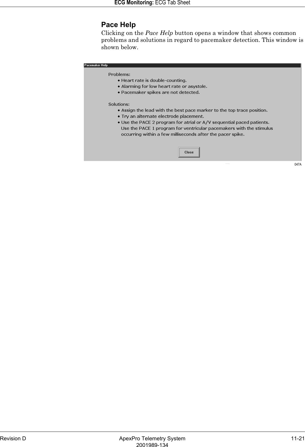 Revision D ApexPro Telemetry System 11-212001989-134ECG Monitoring: ECG Tab SheetPace HelpClicking on the Pace Help button opens a window that shows common problems and solutions in regard to pacemaker detection. This window is shown below. 047A