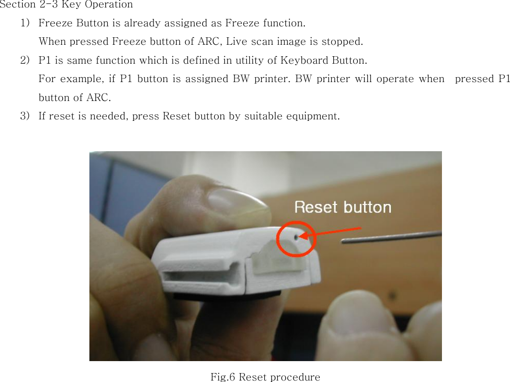 Section 2-3 Key Operation 1) Freeze Button is already assigned as Freeze function. When pressed Freeze button of ARC, Live scan image is stopped. 2) P1 is same function which is defined in utility of Keyboard Button. For example, if P1 button is assigned BW printer. BW printer will operate when    pressed P1 button of ARC.   3) If reset is needed, press Reset button by suitable equipment.   Fig.6 Reset procedure 