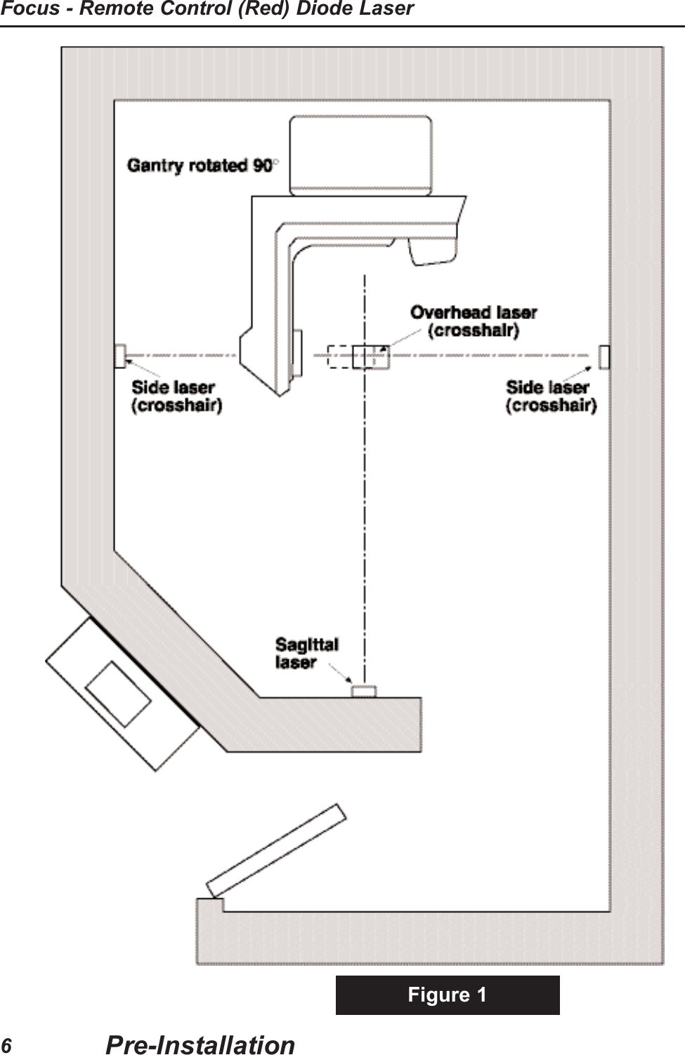Figure 1Pre-InstallationFocus - Remote Control (Red) Diode Laser6